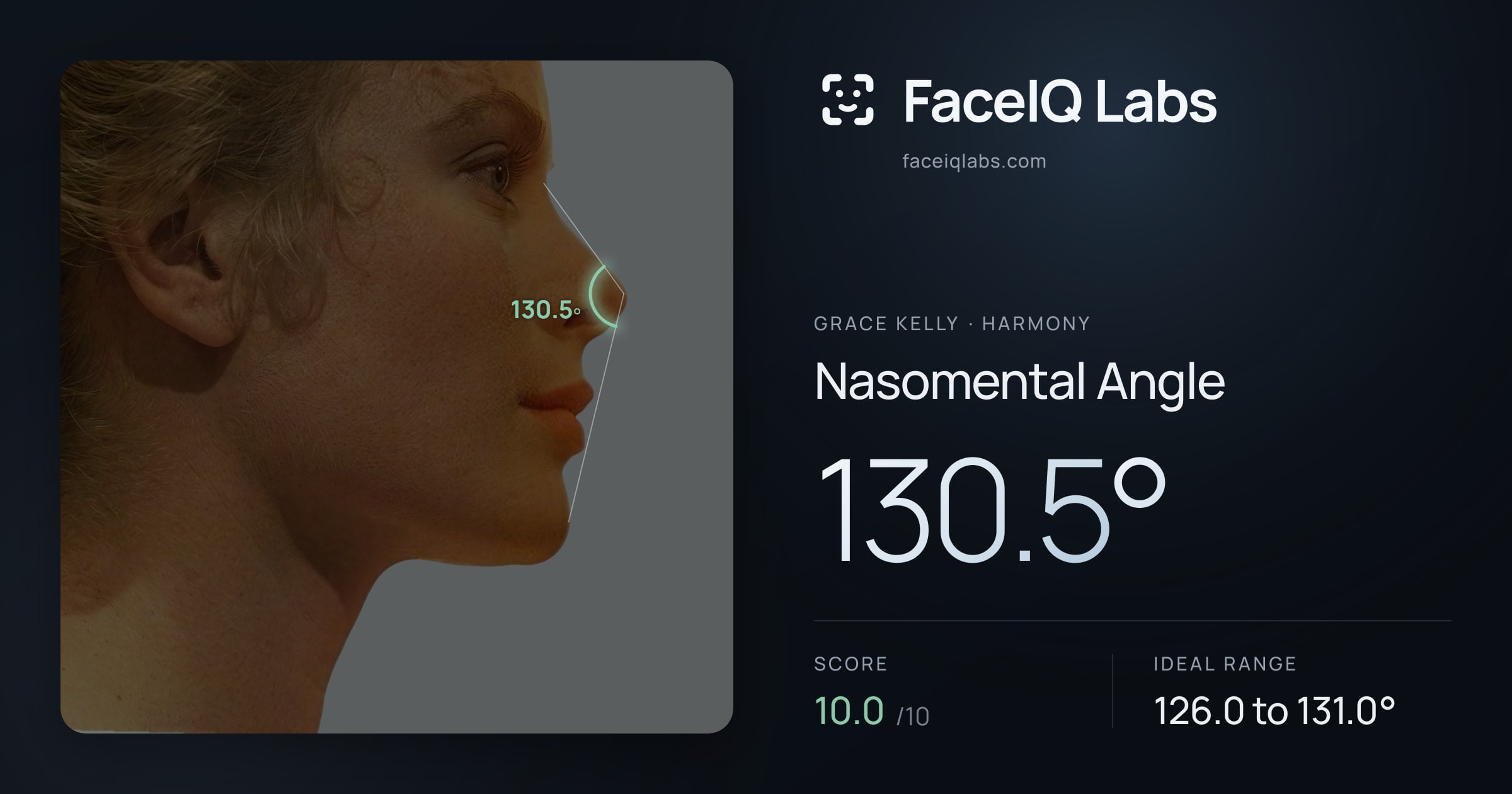 Grace Kelly Nasomental Angle: 130.5°, drawn on the photo