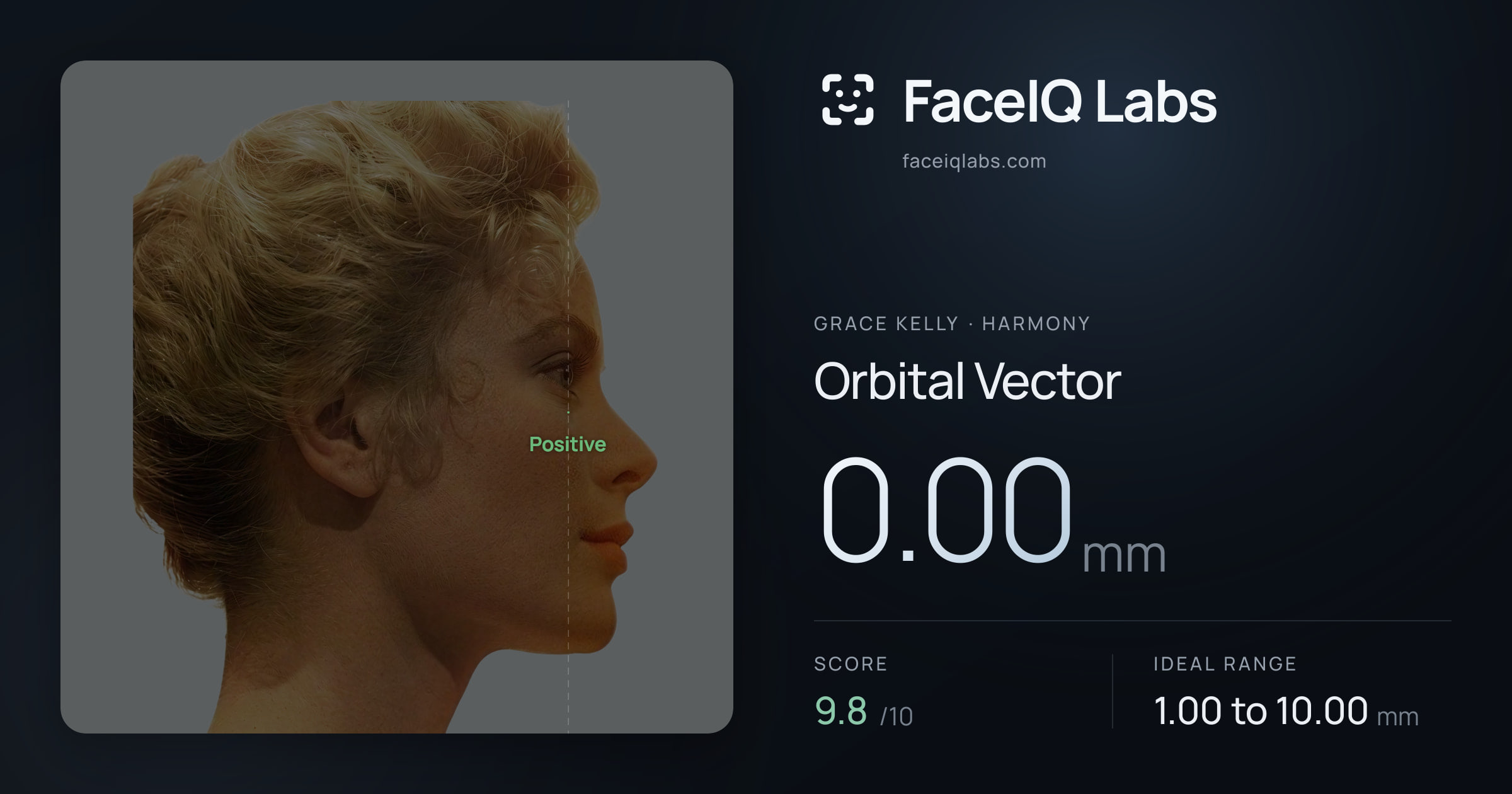 Grace Kelly Orbital Vector: 0.00mm, drawn on the photo