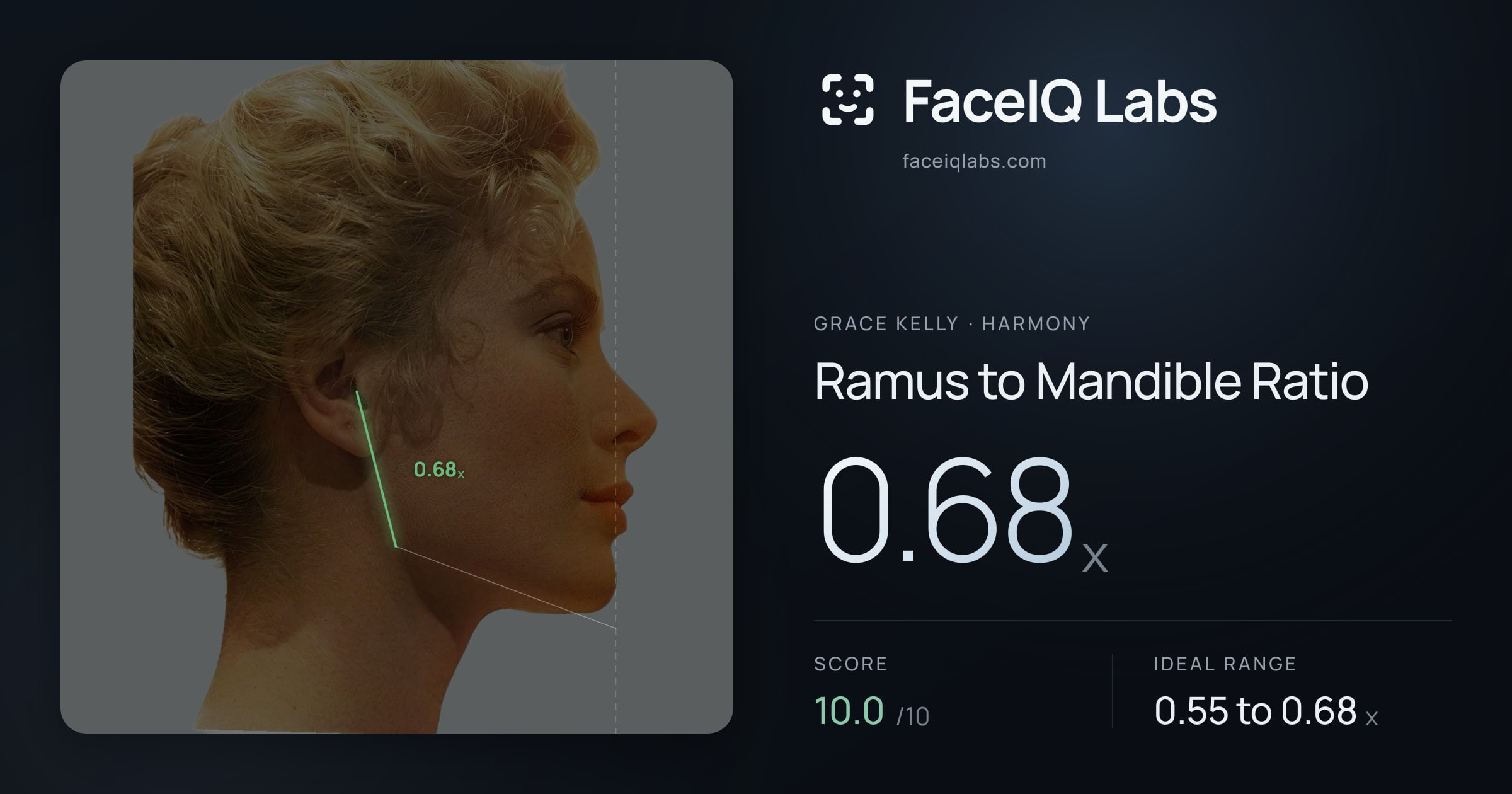 Grace Kelly Ramus to Mandible Ratio: 0.68x, drawn on the photo