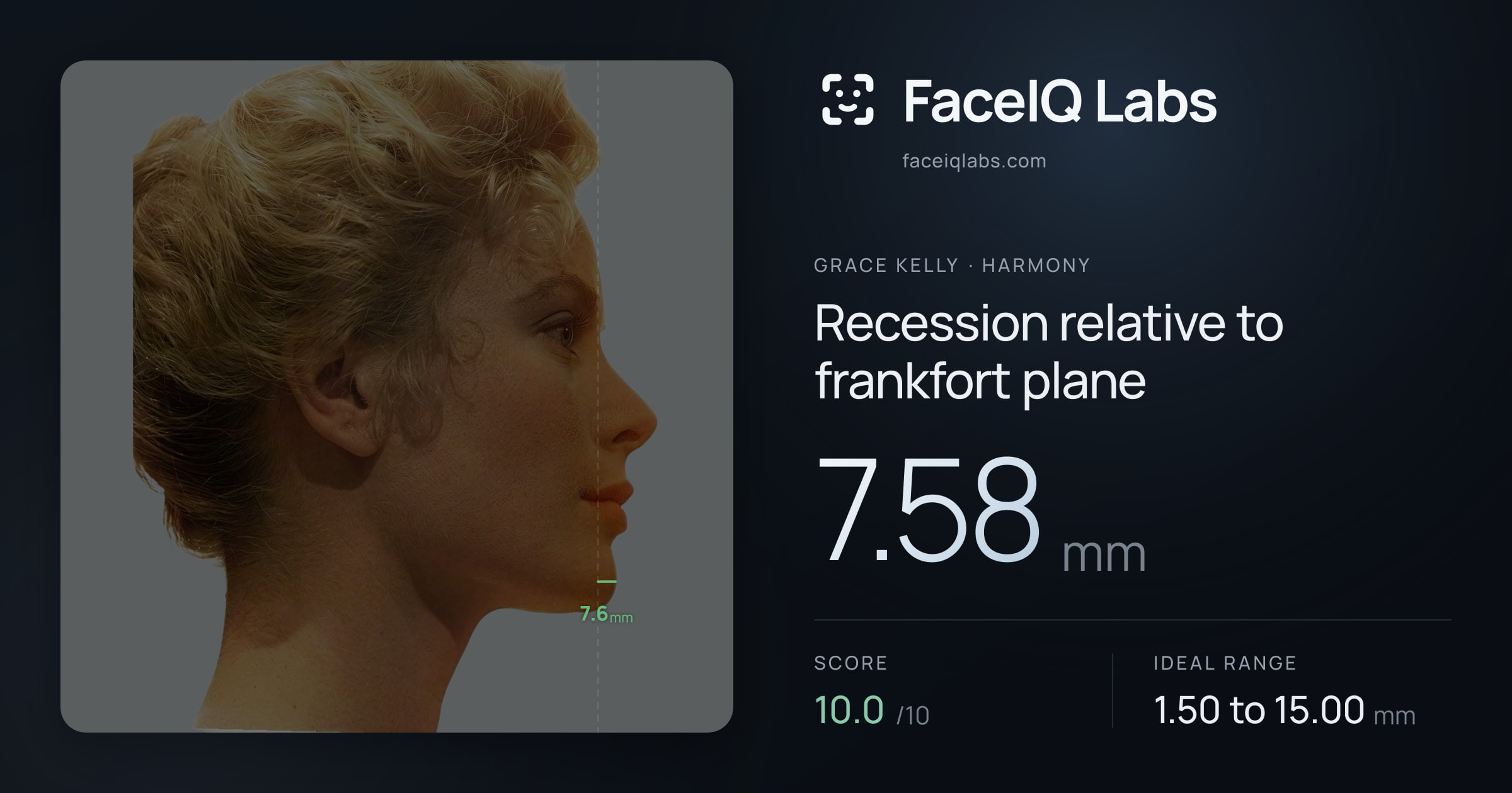 Grace Kelly Recession relative to frankfort plane: 7.58mm, drawn on the photo