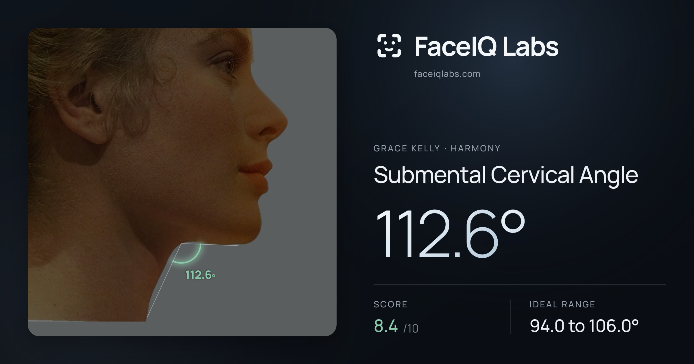 Grace Kelly Submental Cervical Angle: 112.6°, drawn on the photo