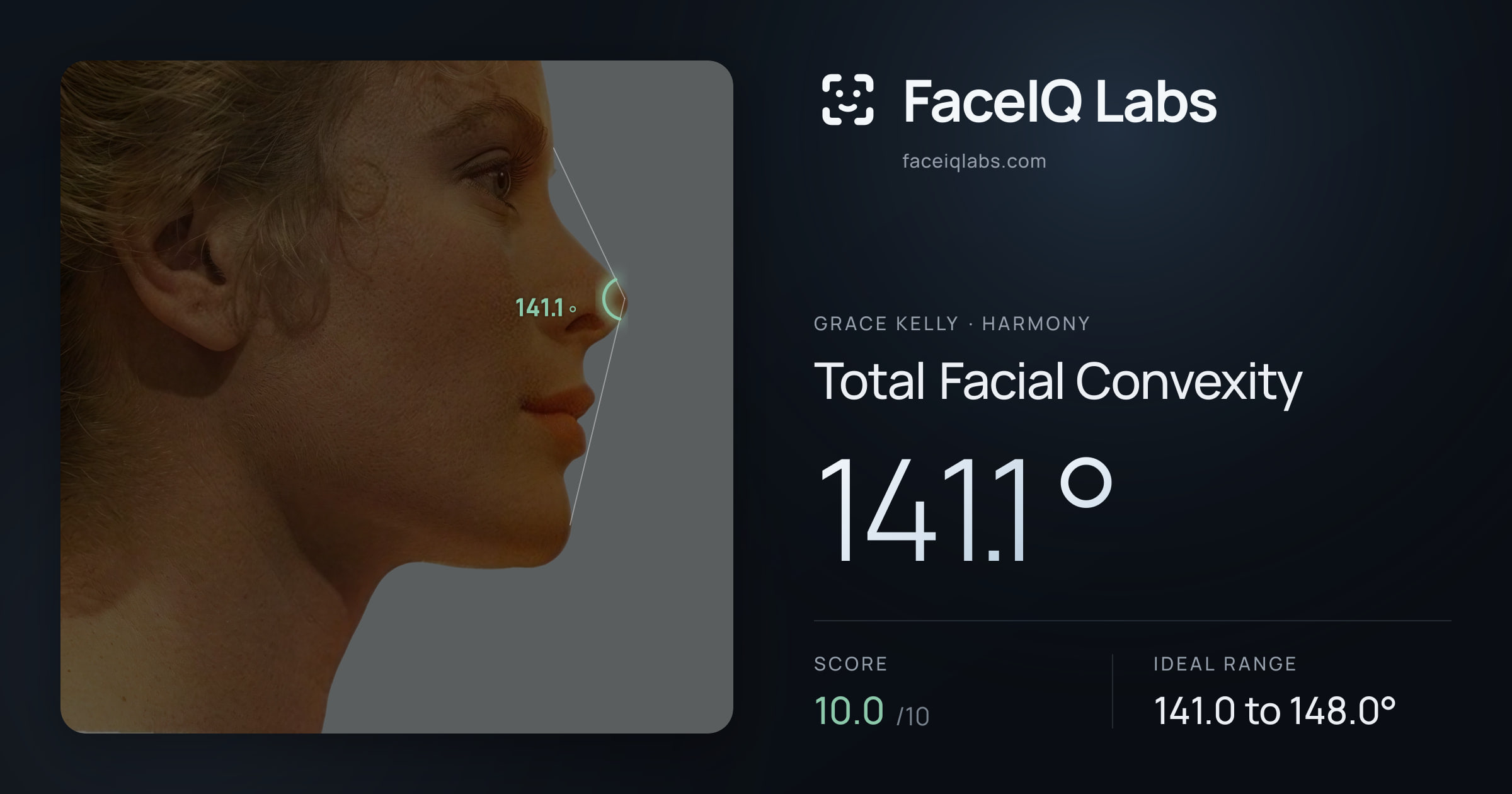 Grace Kelly Total Facial Convexity: 141.1°, drawn on the photo