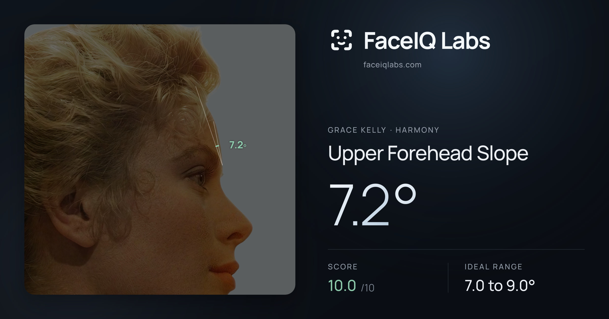 Grace Kelly Upper Forehead Slope: 7.2°, drawn on the photo