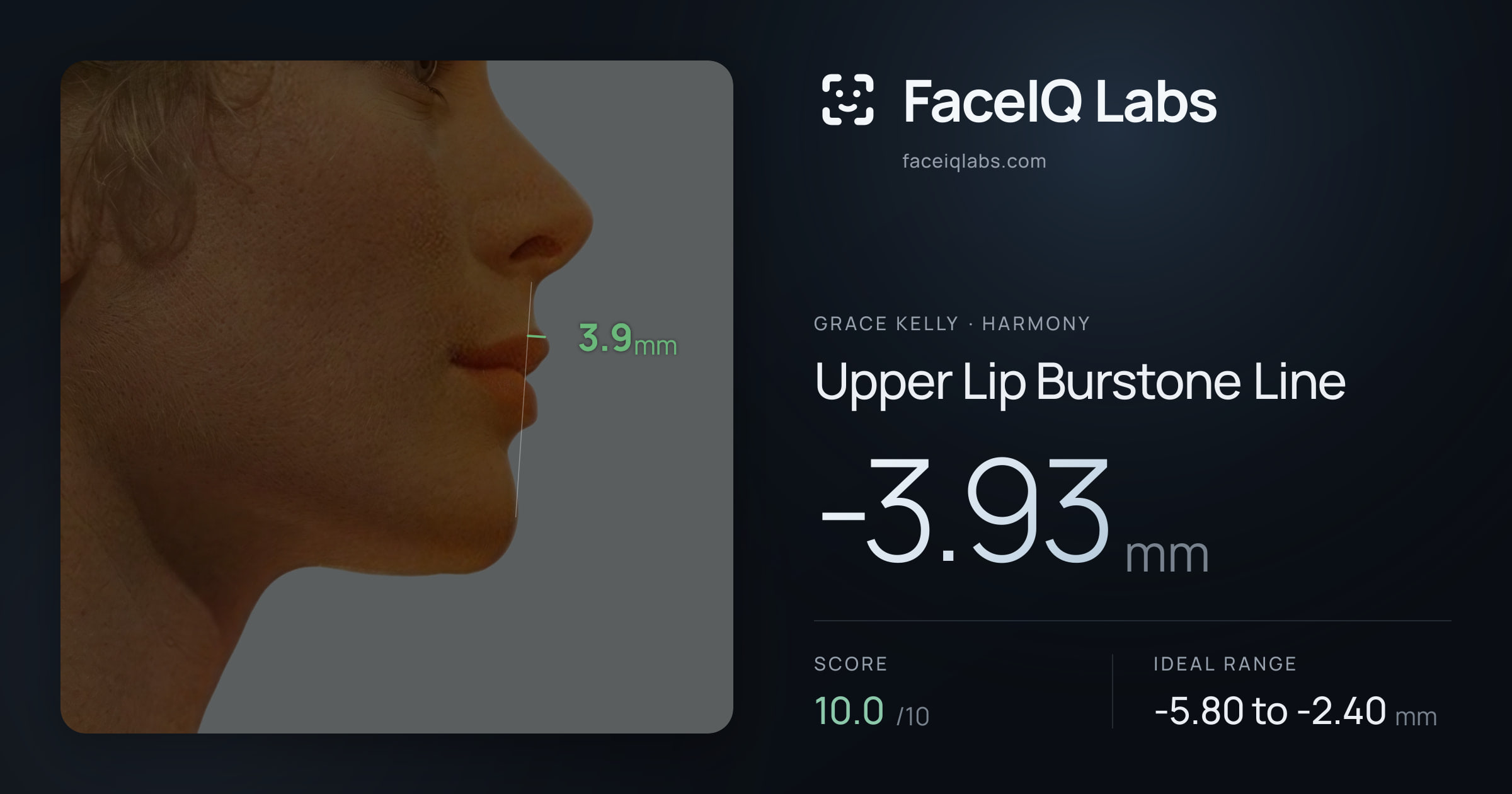 Grace Kelly Upper Lip Burstone Line: -3.93mm, drawn on the photo