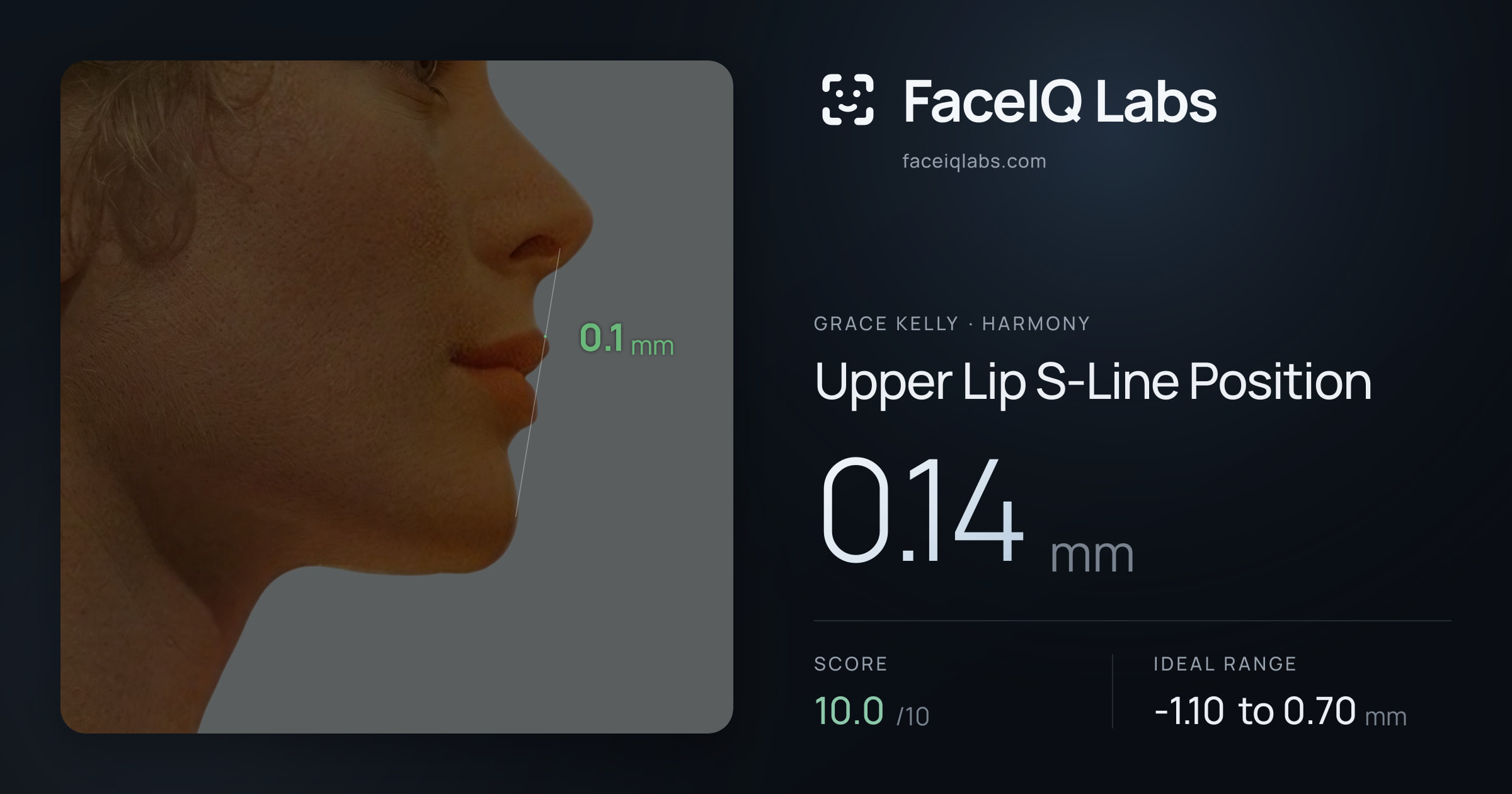 Grace Kelly Upper Lip S-Line Position: 0.14mm, drawn on the photo