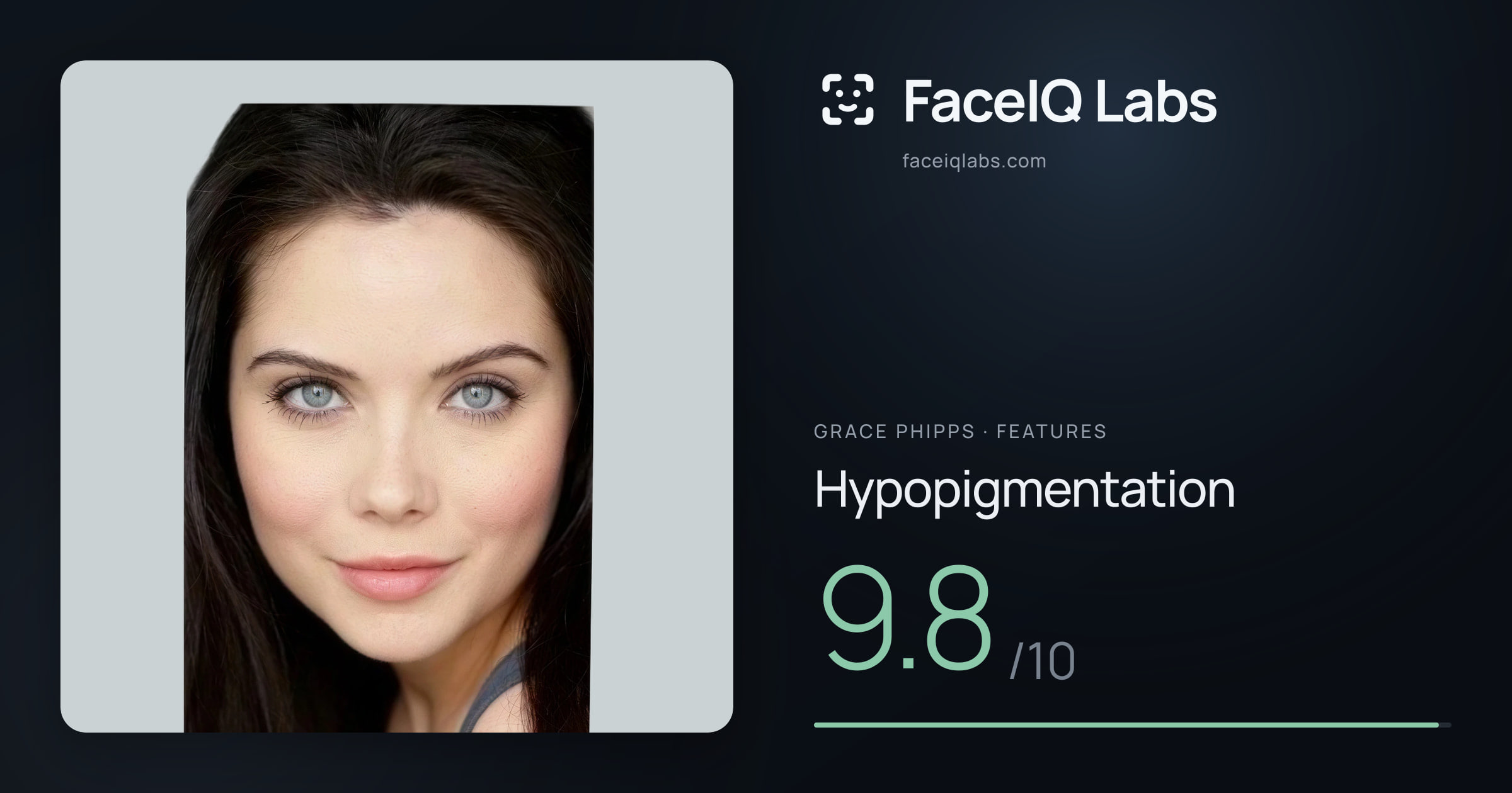 Grace Phipps Hypopigmentation: 9.8/10, drawn on the photo