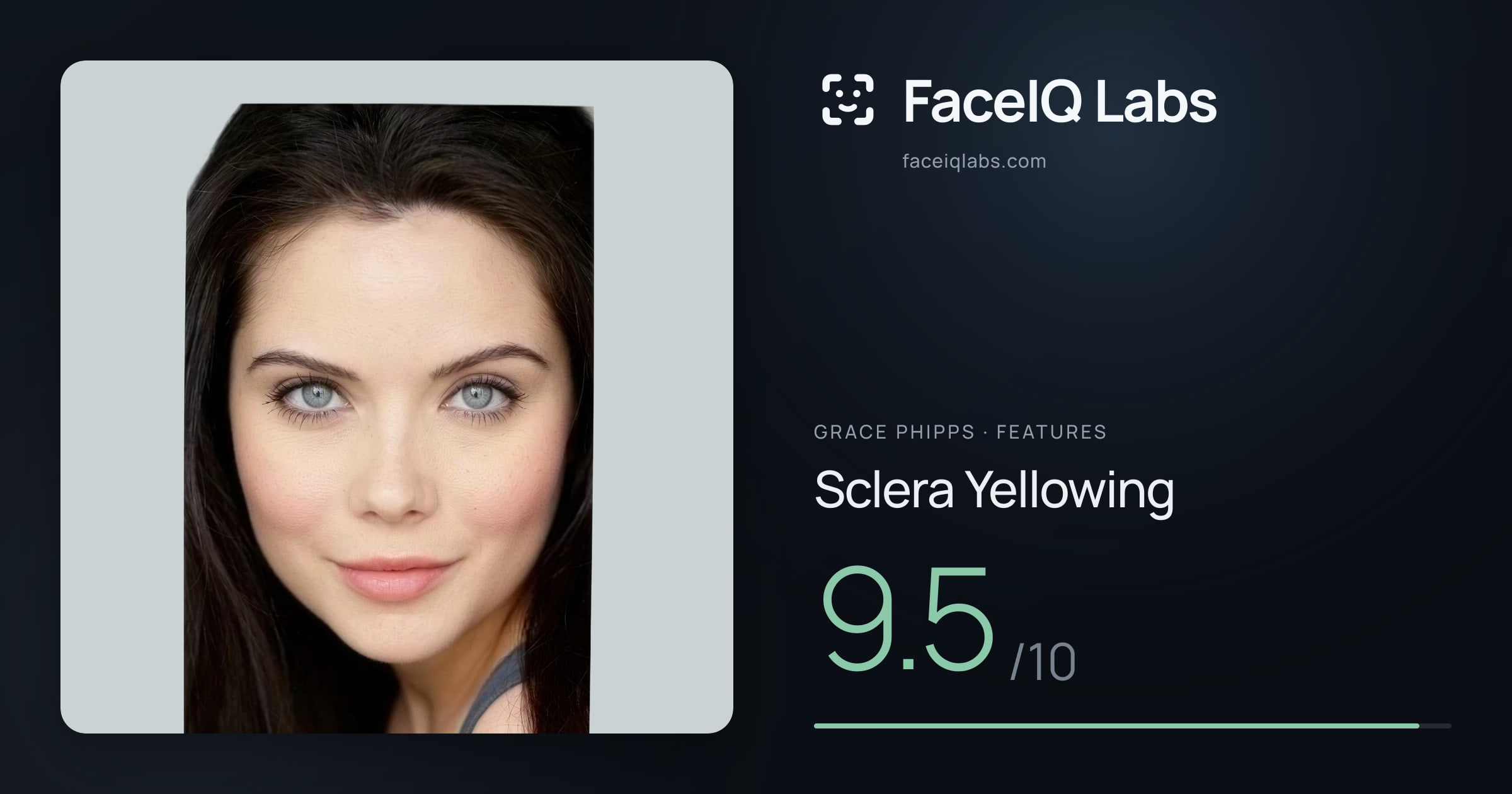 Grace Phipps Sclera Yellowing: 9.5/10, drawn on the photo