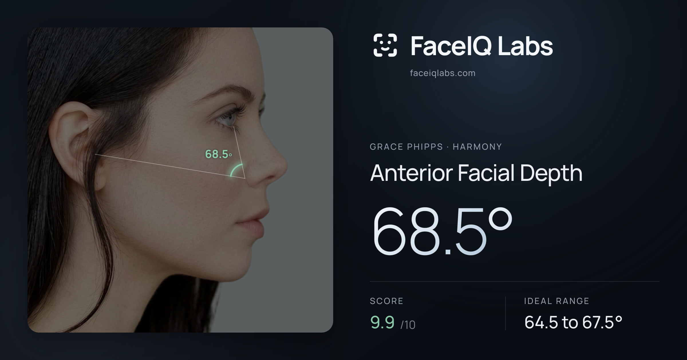 Grace Phipps Anterior Facial Depth: 68.5°, drawn on the photo