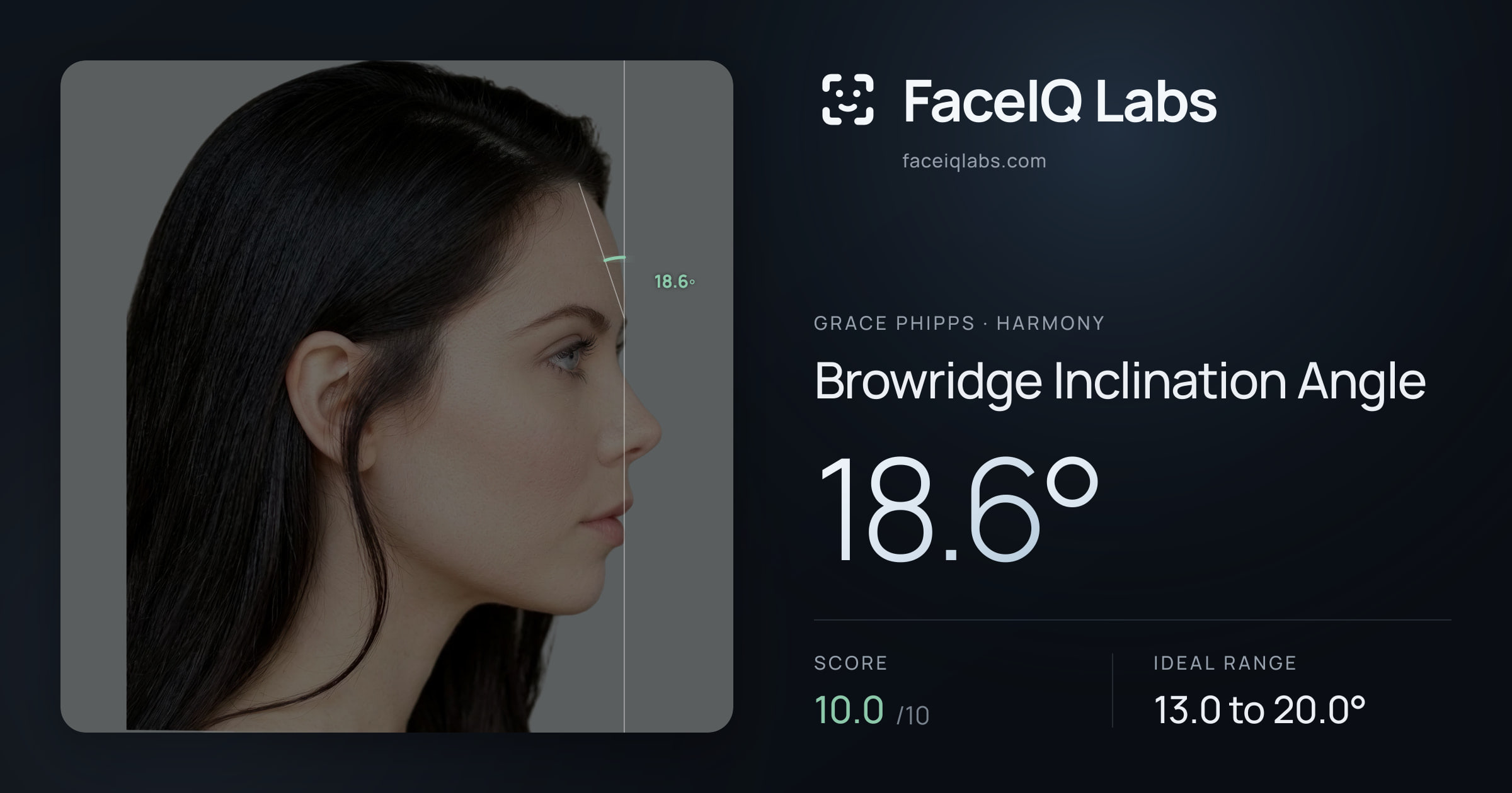 Grace Phipps Browridge Inclination Angle: 18.6°, drawn on the photo