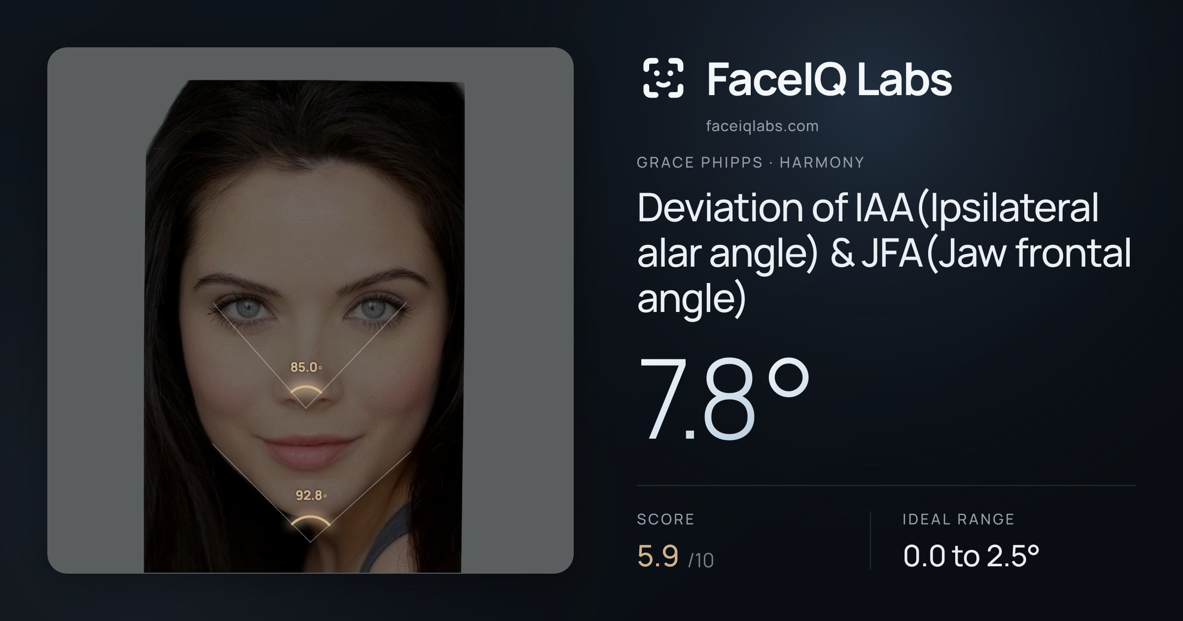 Grace Phipps Deviation of IAA(Ipsilateral alar angle) & JFA(Jaw frontal angle): 7.8°, drawn on the photo