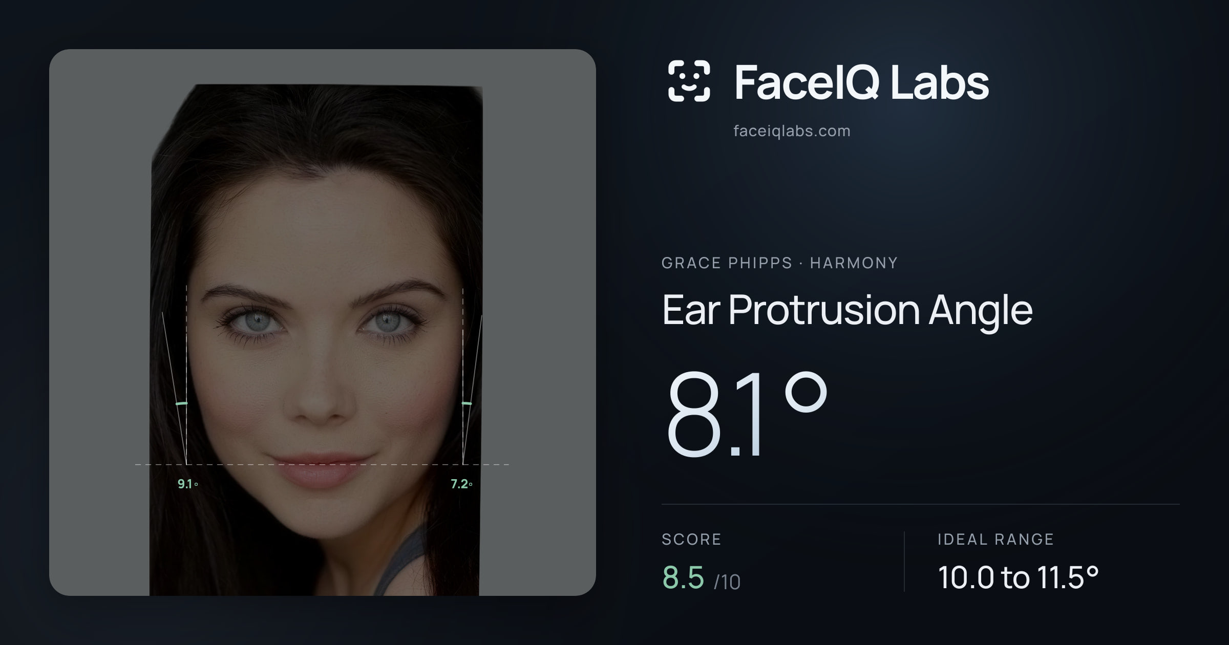 Grace Phipps Ear Protrusion Angle: 8.1°, drawn on the photo