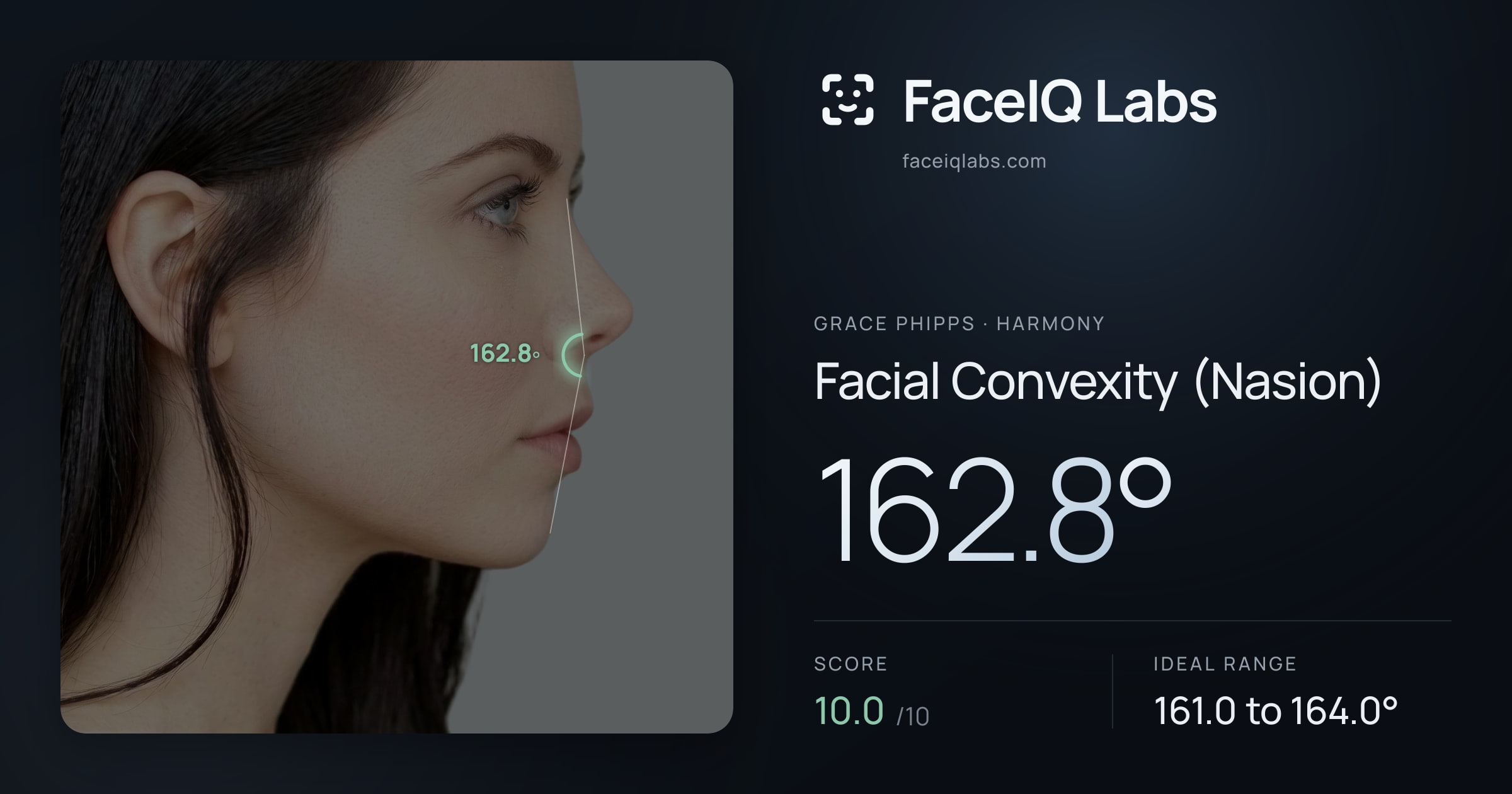 Grace Phipps Facial Convexity (Nasion): 162.8°, drawn on the photo