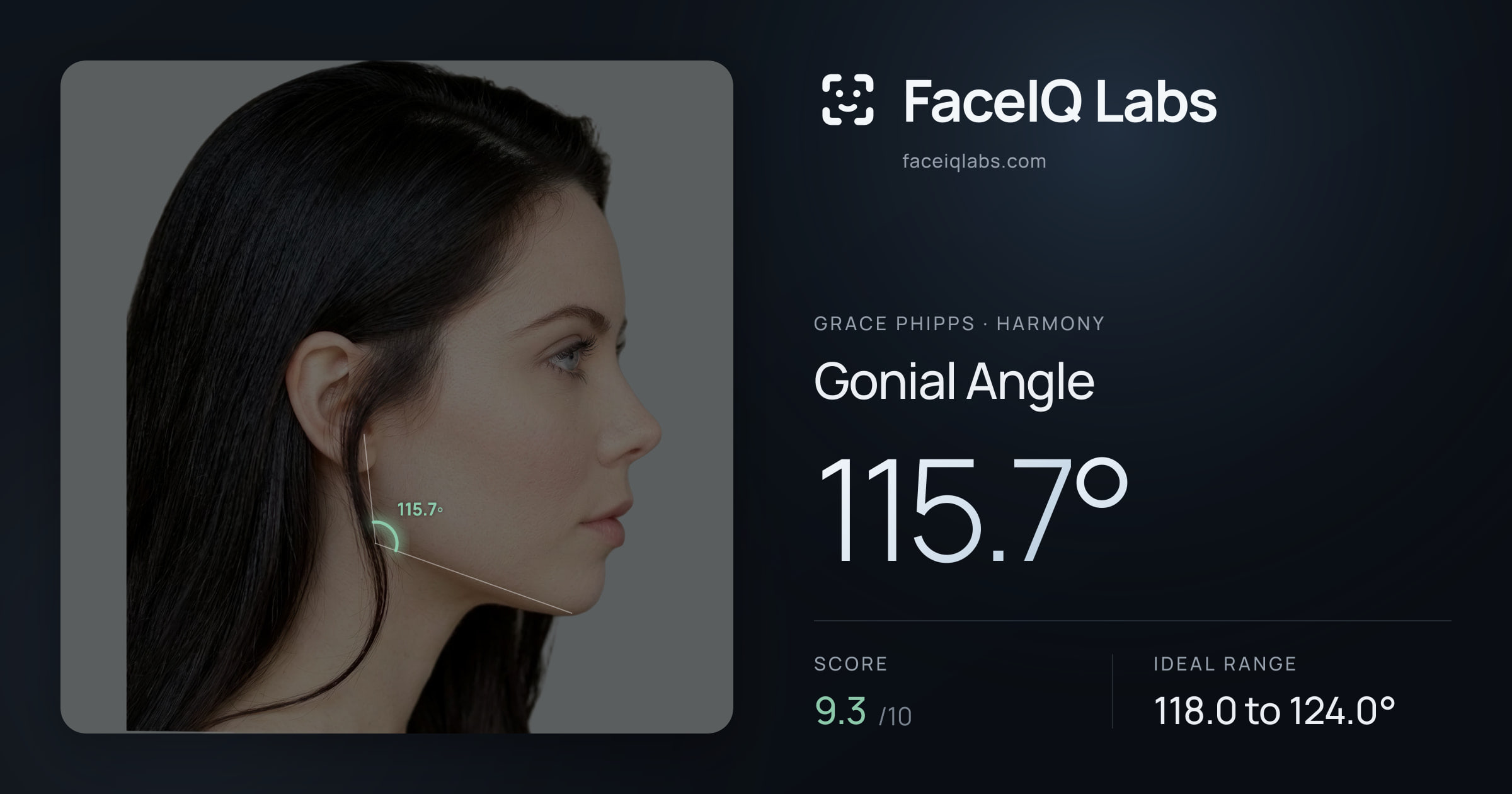 Grace Phipps Gonial Angle: 115.7°, drawn on the photo