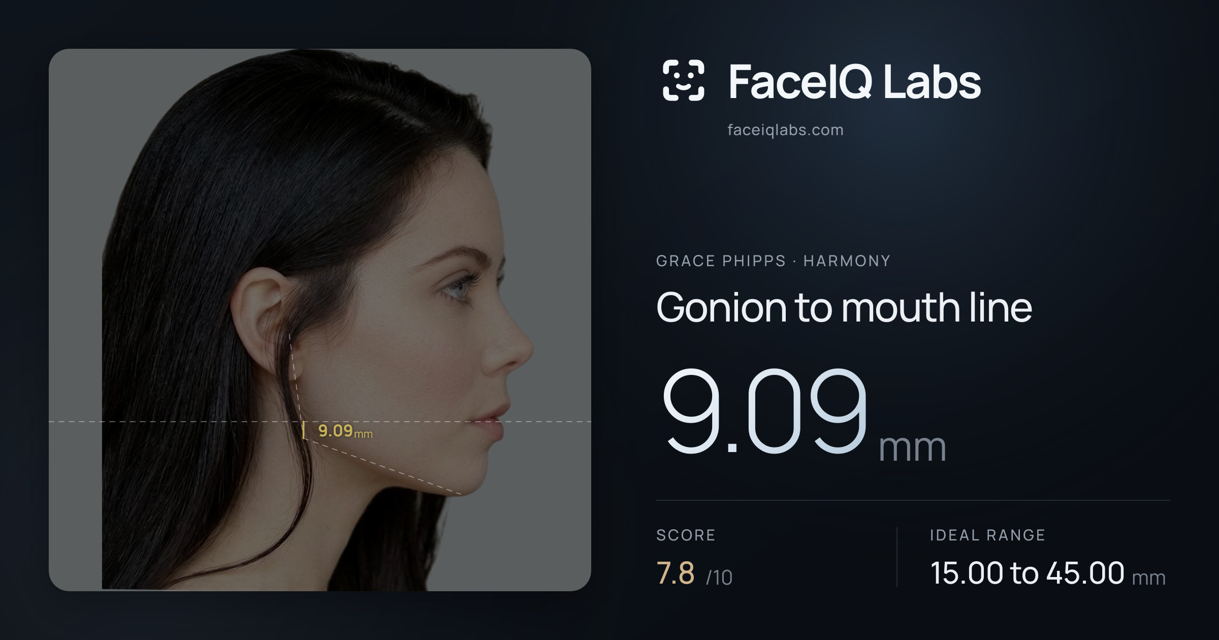 Grace Phipps Gonion to mouth line: 9.09mm, drawn on the photo