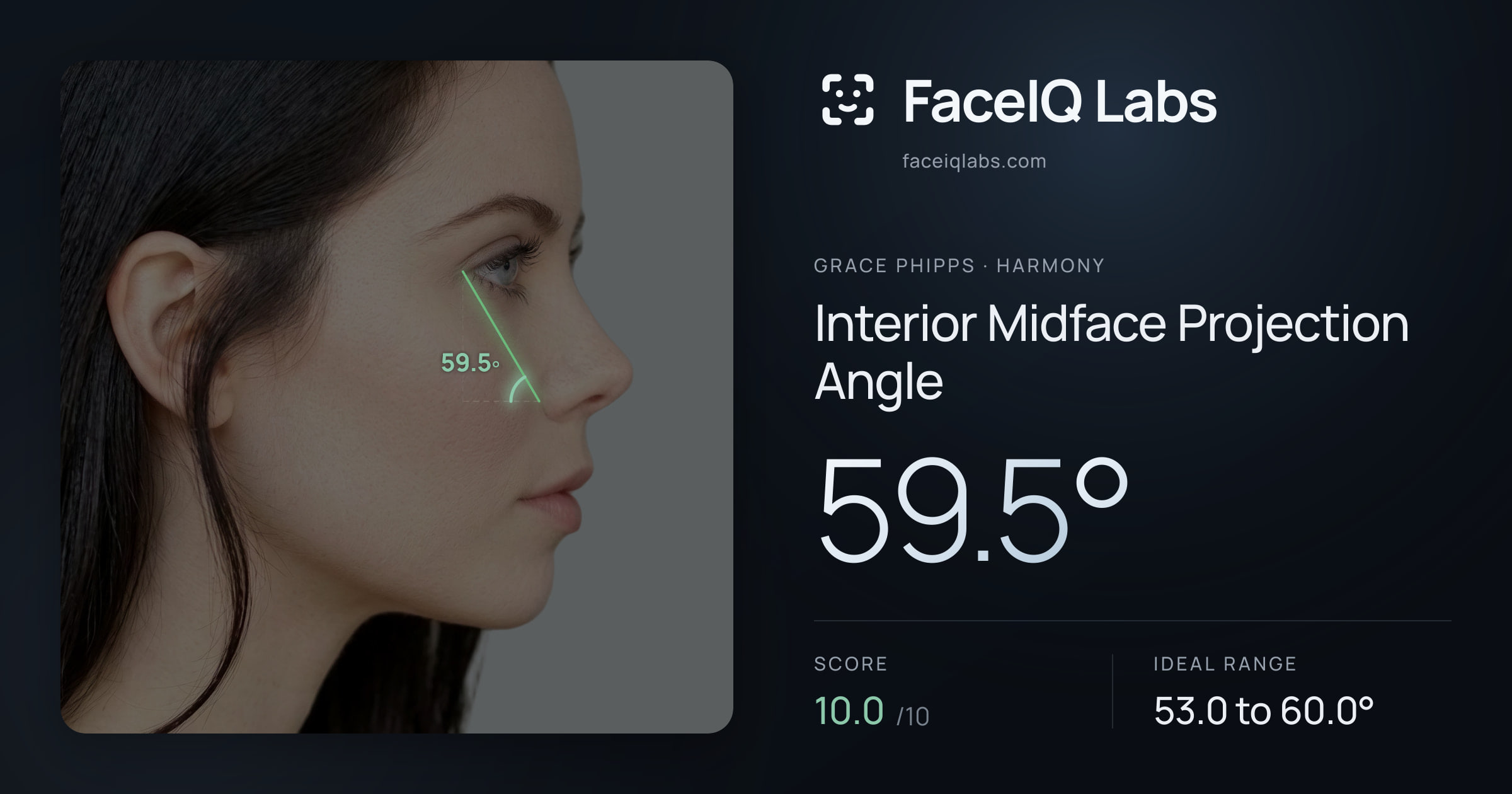 Grace Phipps Interior Midface Projection Angle: 59.5°, drawn on the photo