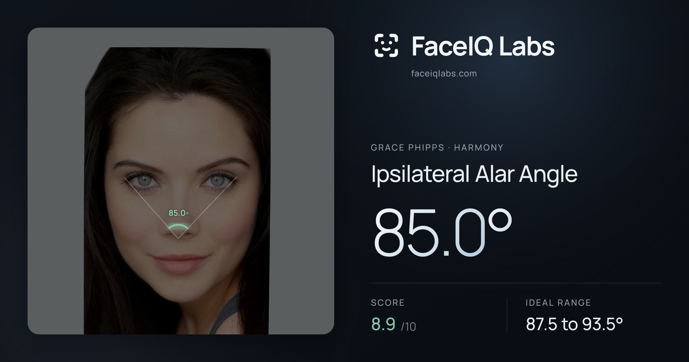 Grace Phipps Ipsilateral Alar Angle: 85.0°, drawn on the photo