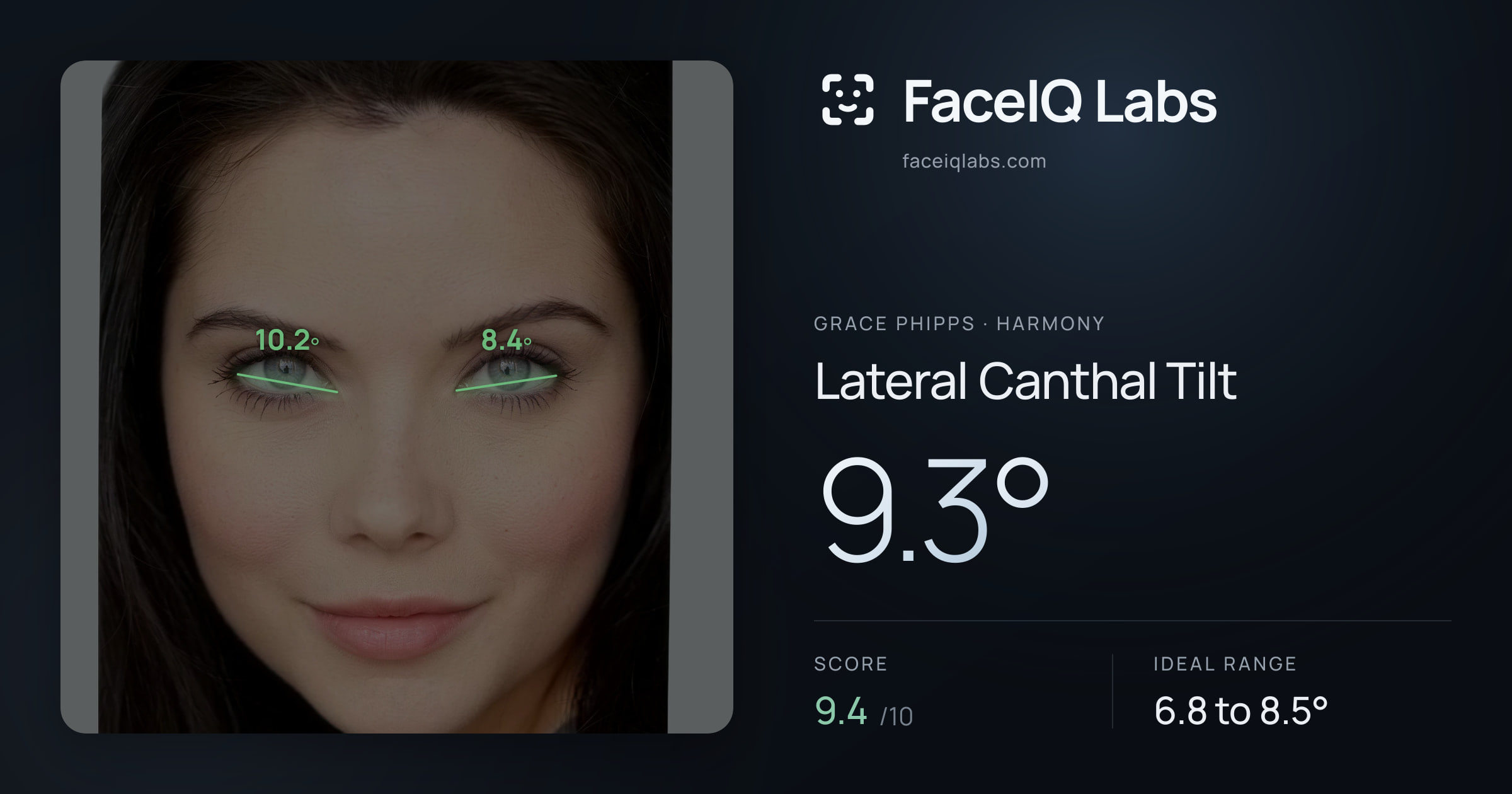 Grace Phipps Lateral Canthal Tilt: 9.3°, drawn on the photo
