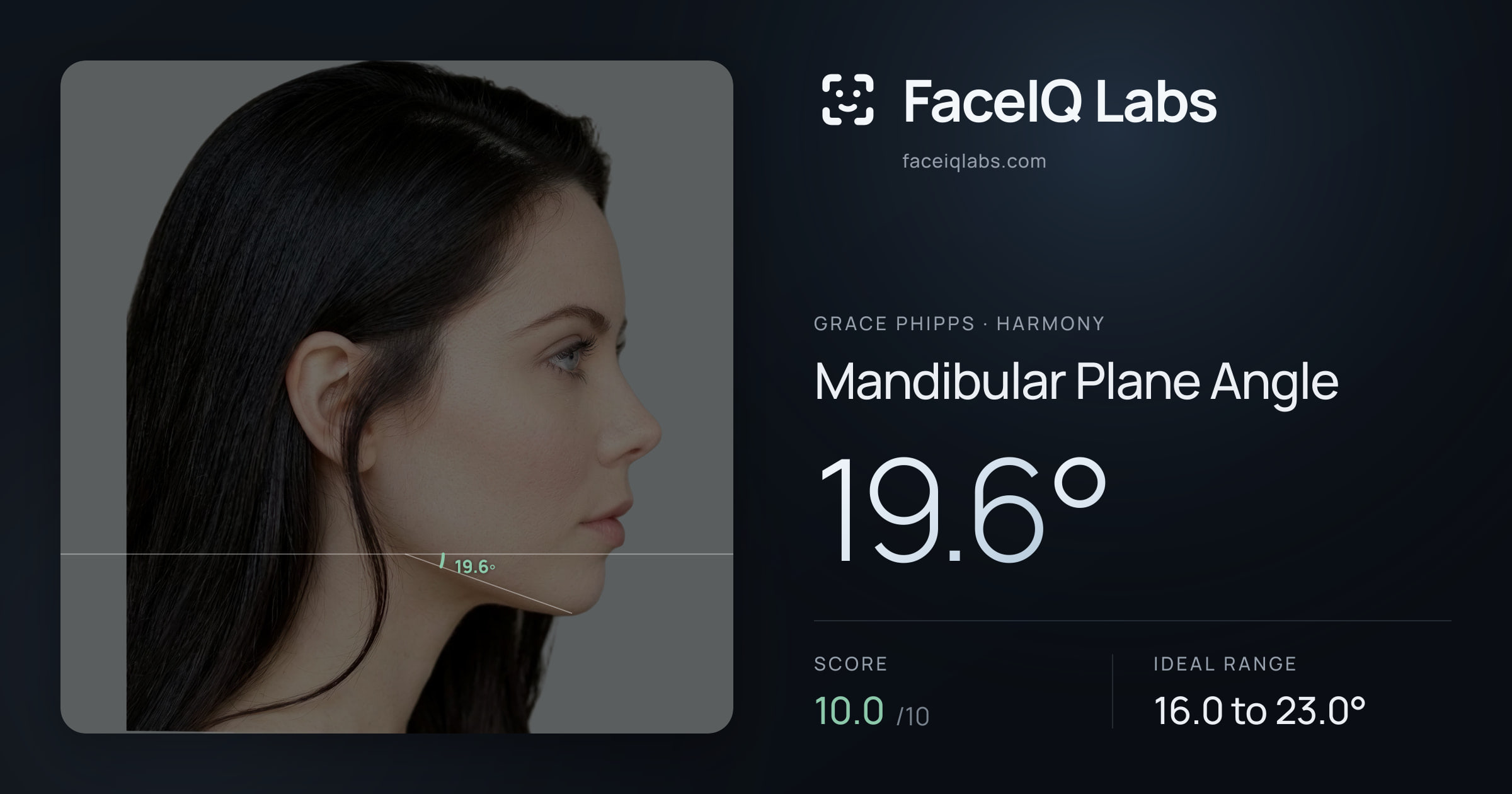 Grace Phipps Mandibular Plane Angle: 19.6°, drawn on the photo