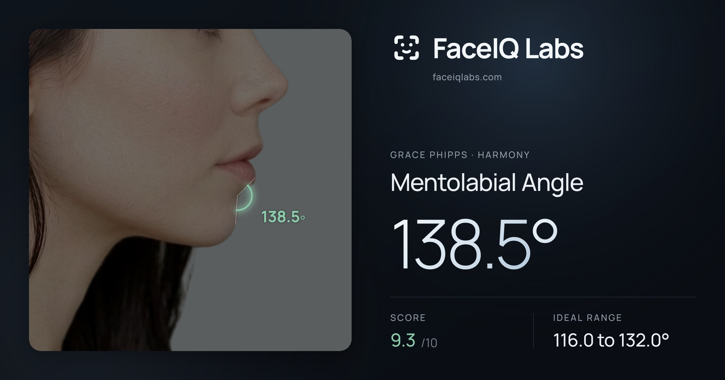 Grace Phipps Mentolabial Angle: 138.5°, drawn on the photo