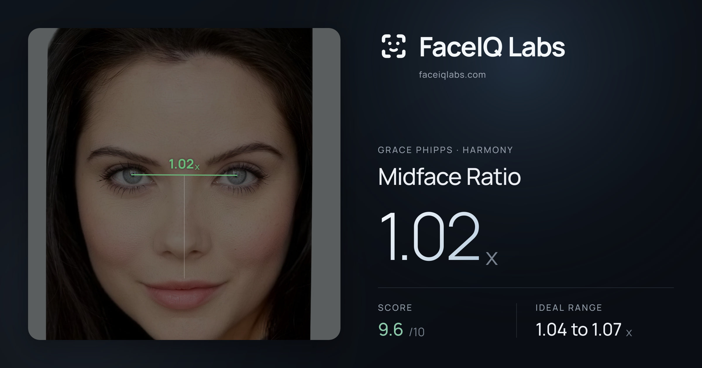 Grace Phipps Midface Ratio: 1.02x, drawn on the photo