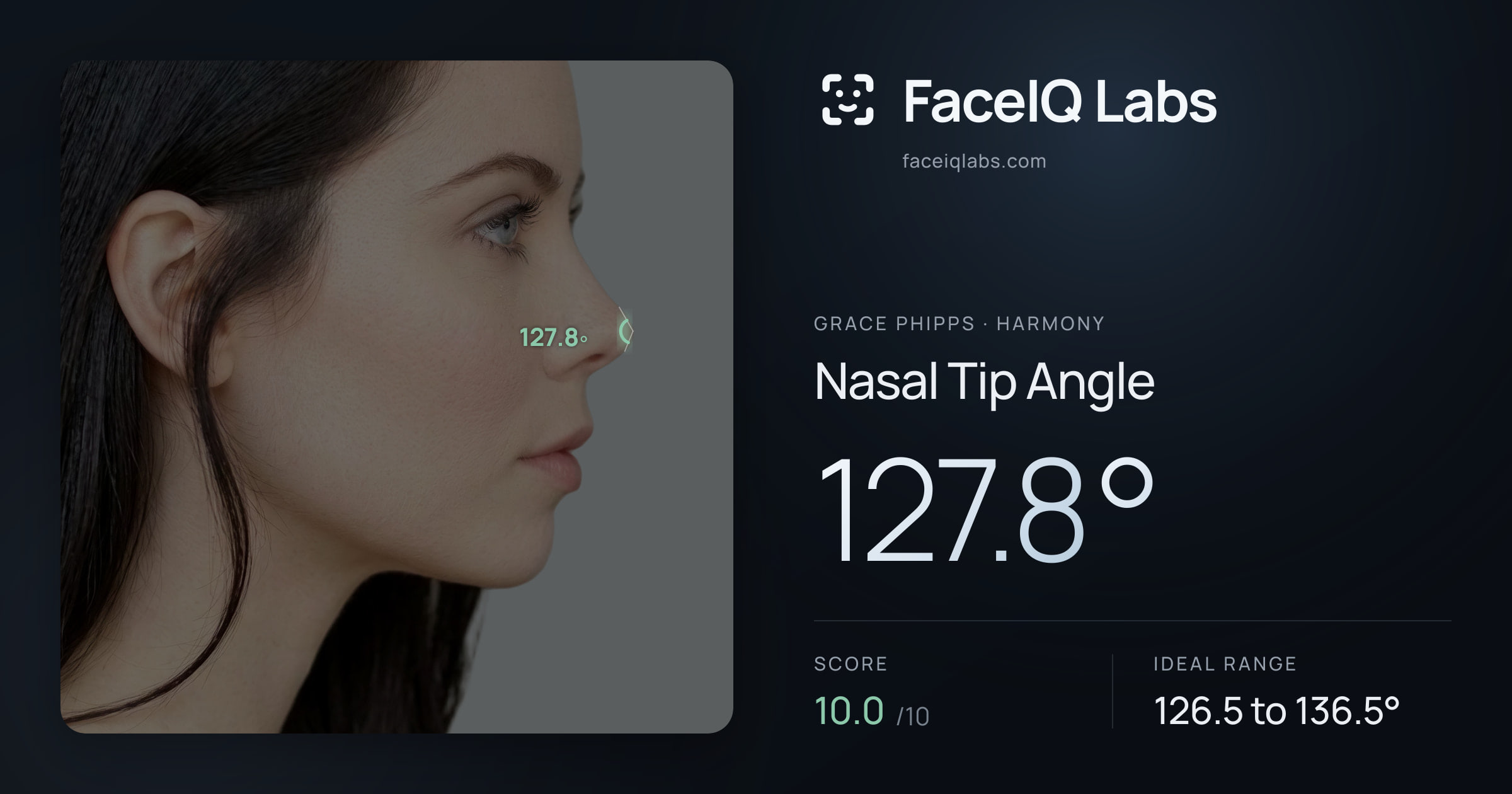 Grace Phipps Nasal Tip Angle: 127.8°, drawn on the photo