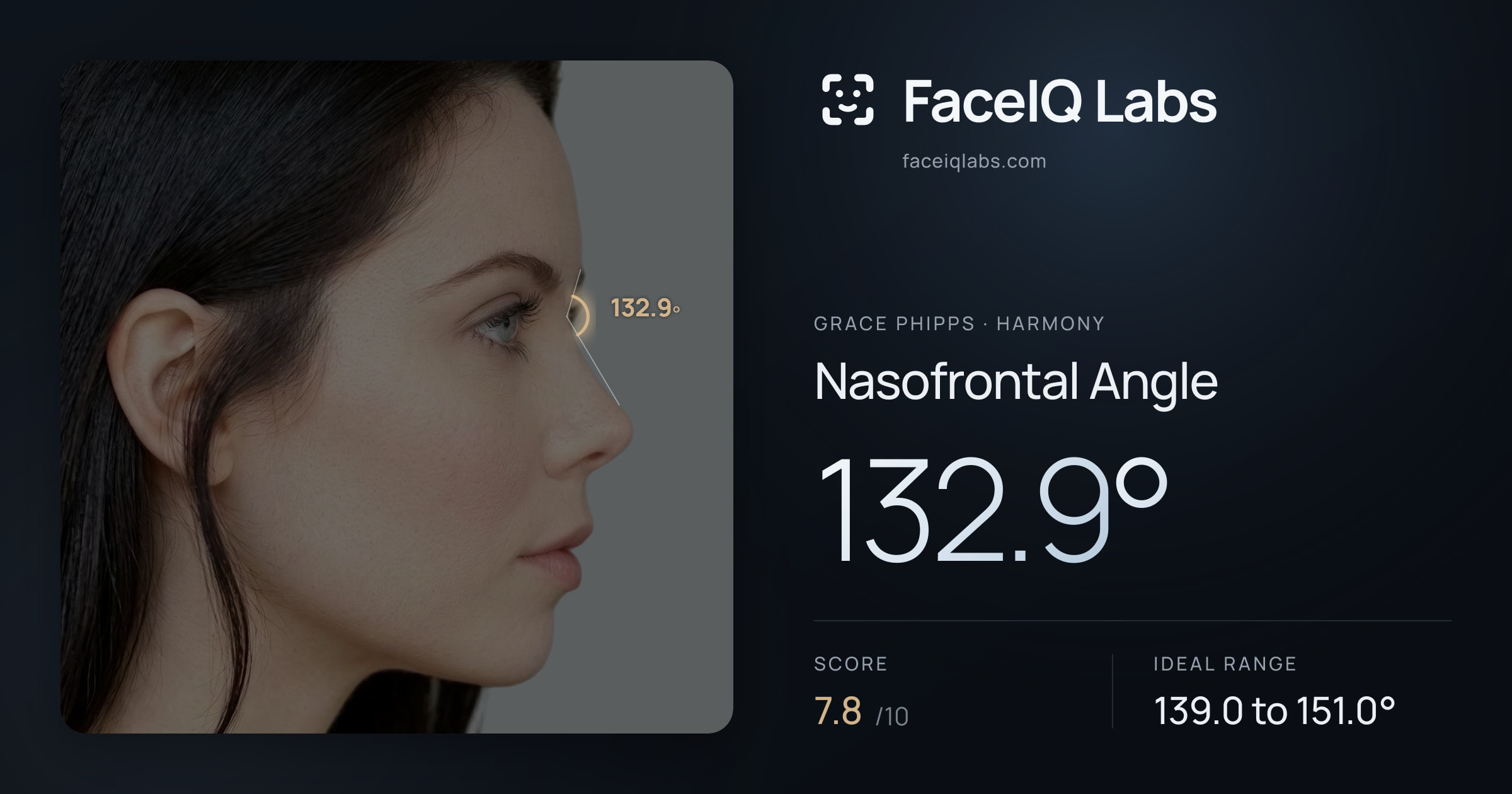 Grace Phipps Nasofrontal Angle: 132.9°, drawn on the photo