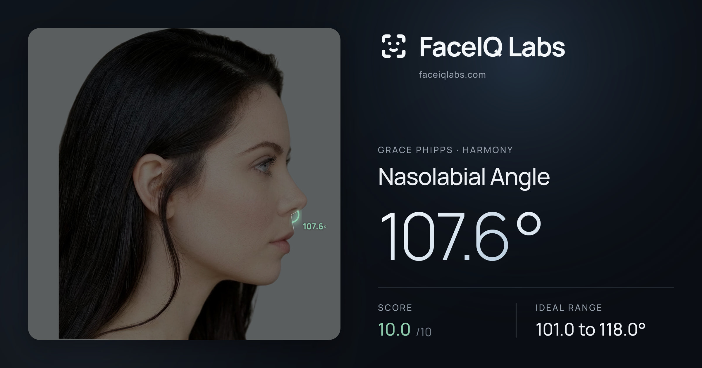 Grace Phipps Nasolabial Angle: 107.6°, drawn on the photo