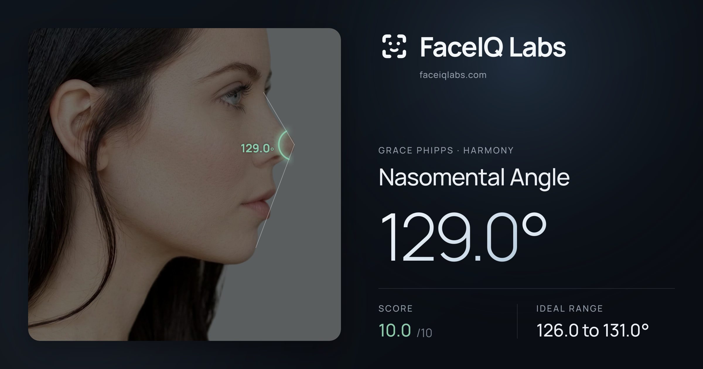 Grace Phipps Nasomental Angle: 129.0°, drawn on the photo
