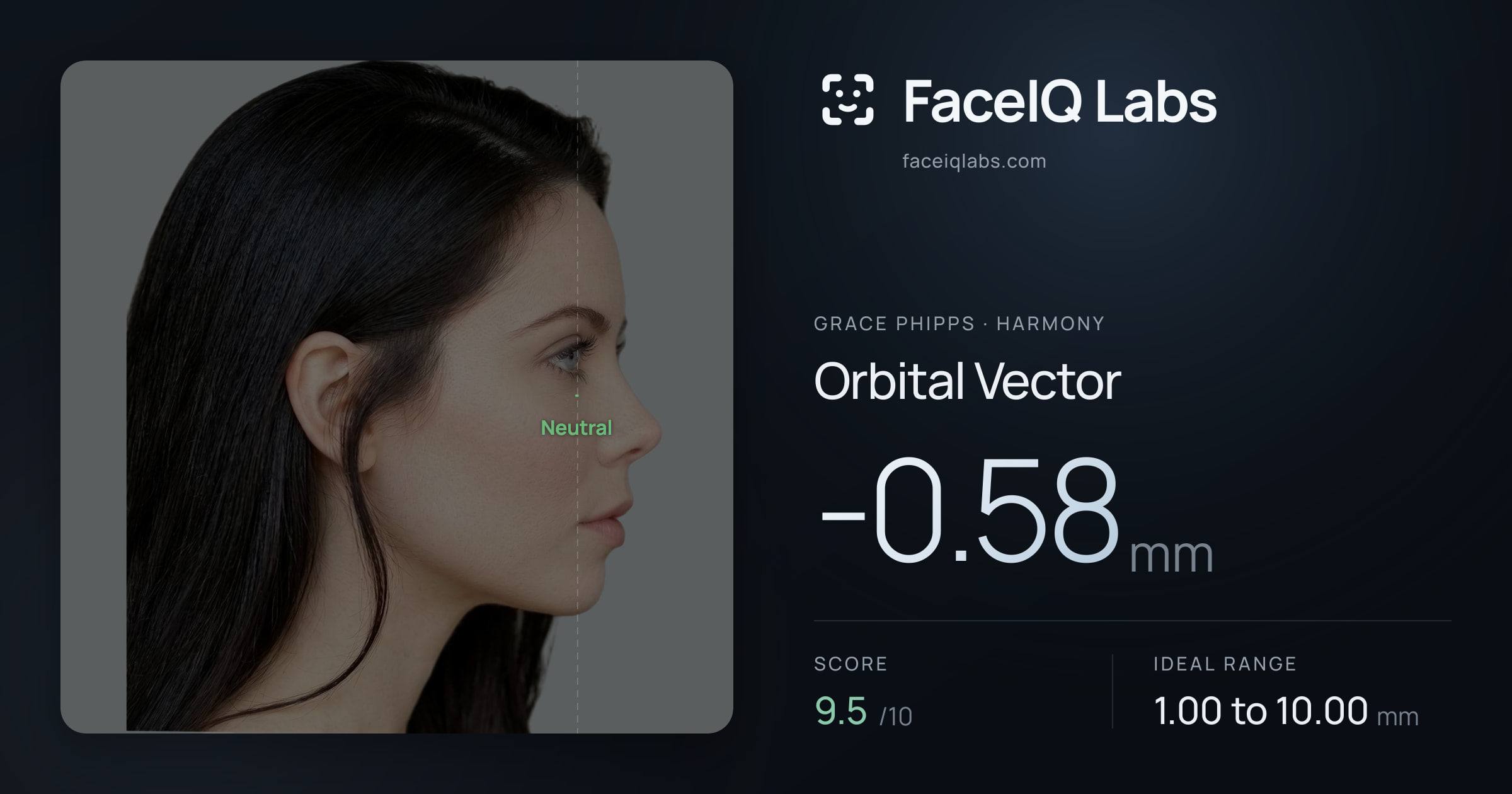 Grace Phipps Orbital Vector: -0.58mm, drawn on the photo