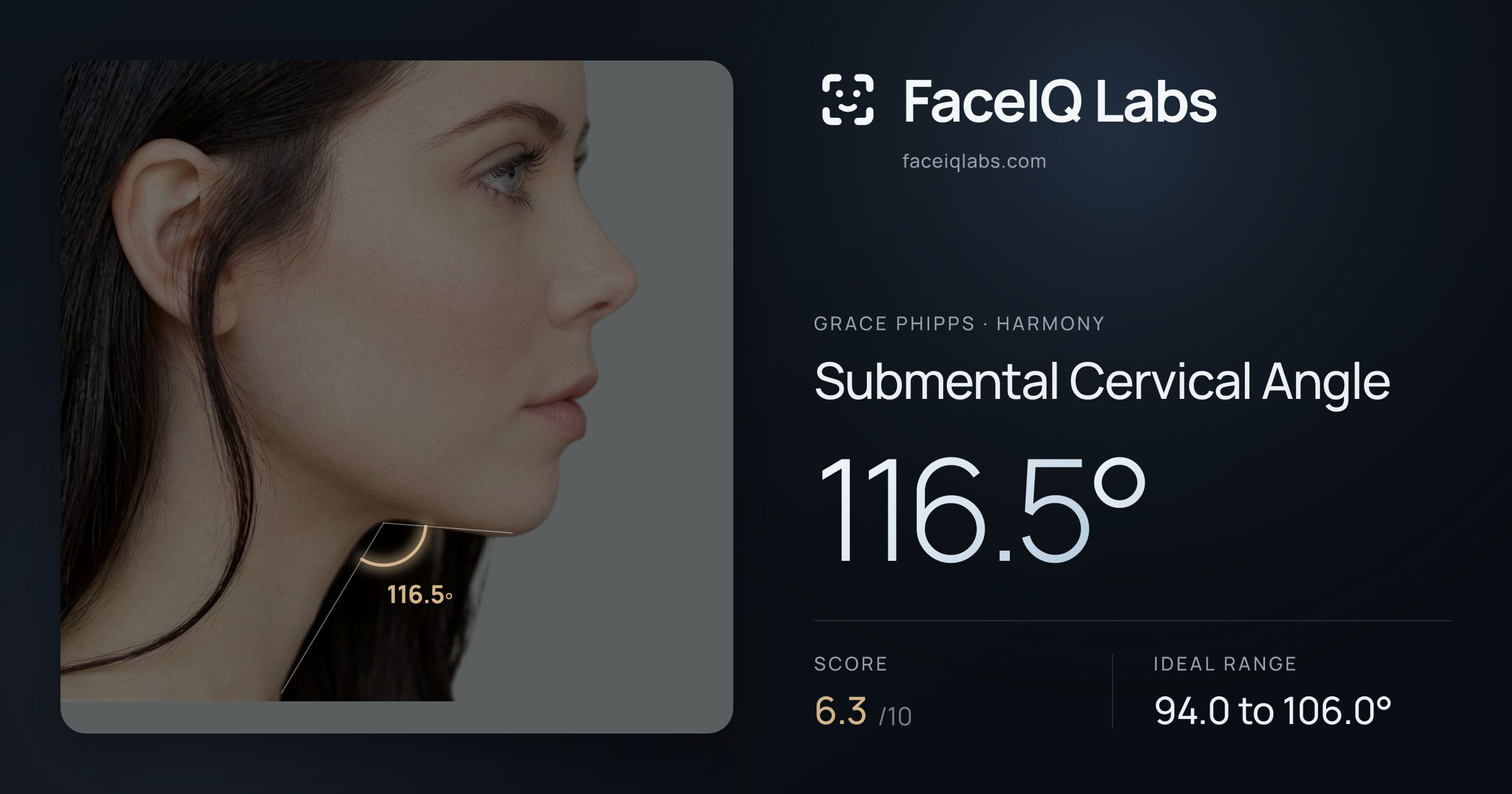Grace Phipps Submental Cervical Angle: 116.5°, drawn on the photo