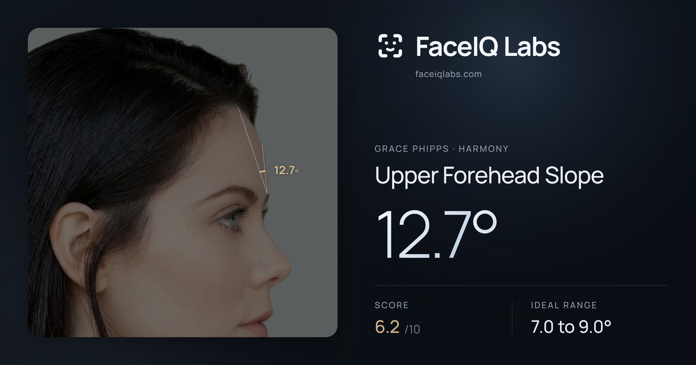 Grace Phipps Upper Forehead Slope: 12.7°, drawn on the photo