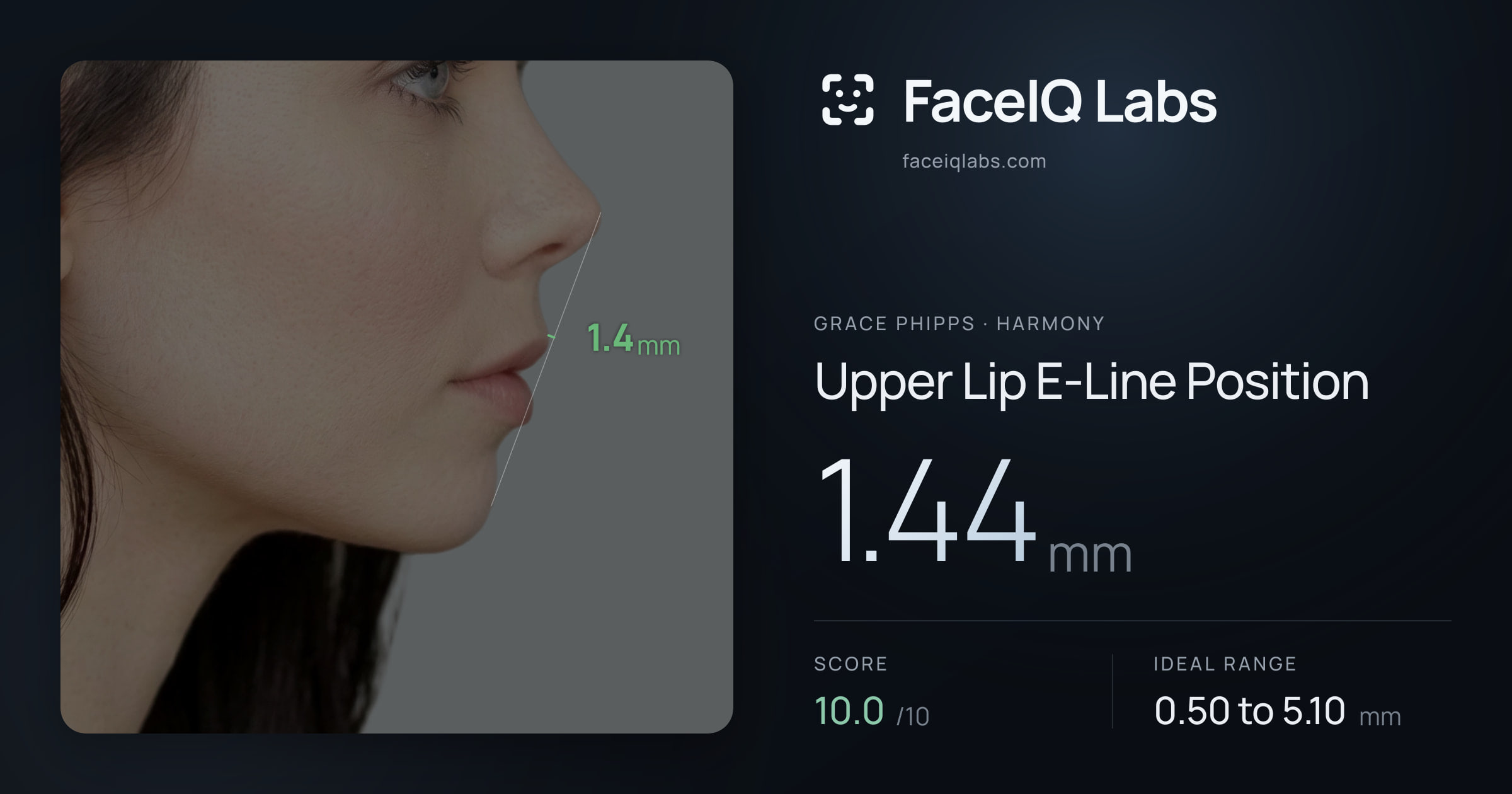 Grace Phipps Upper Lip E-Line Position: 1.44mm, drawn on the photo