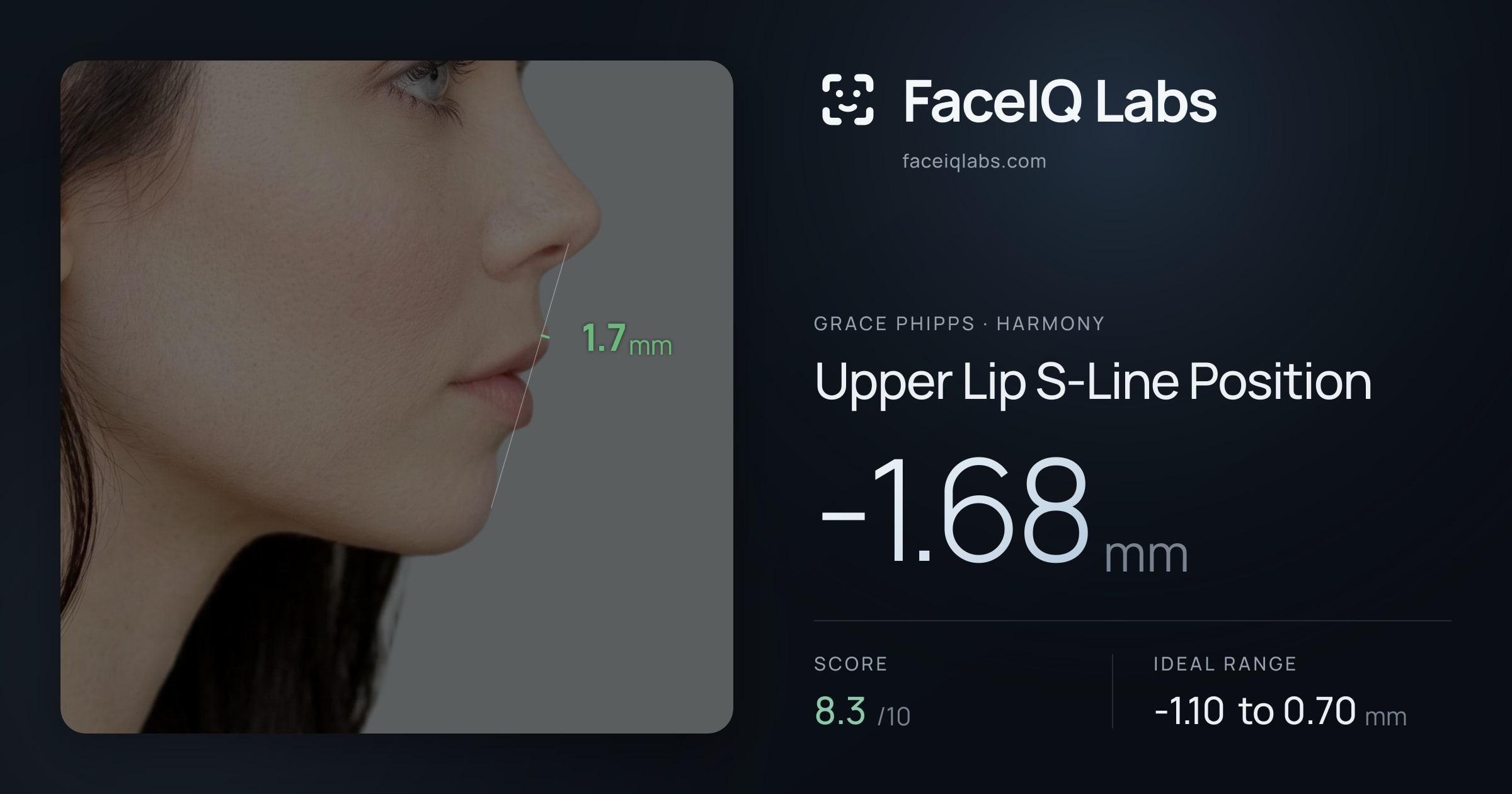 Grace Phipps Upper Lip S-Line Position: -1.68mm, drawn on the photo