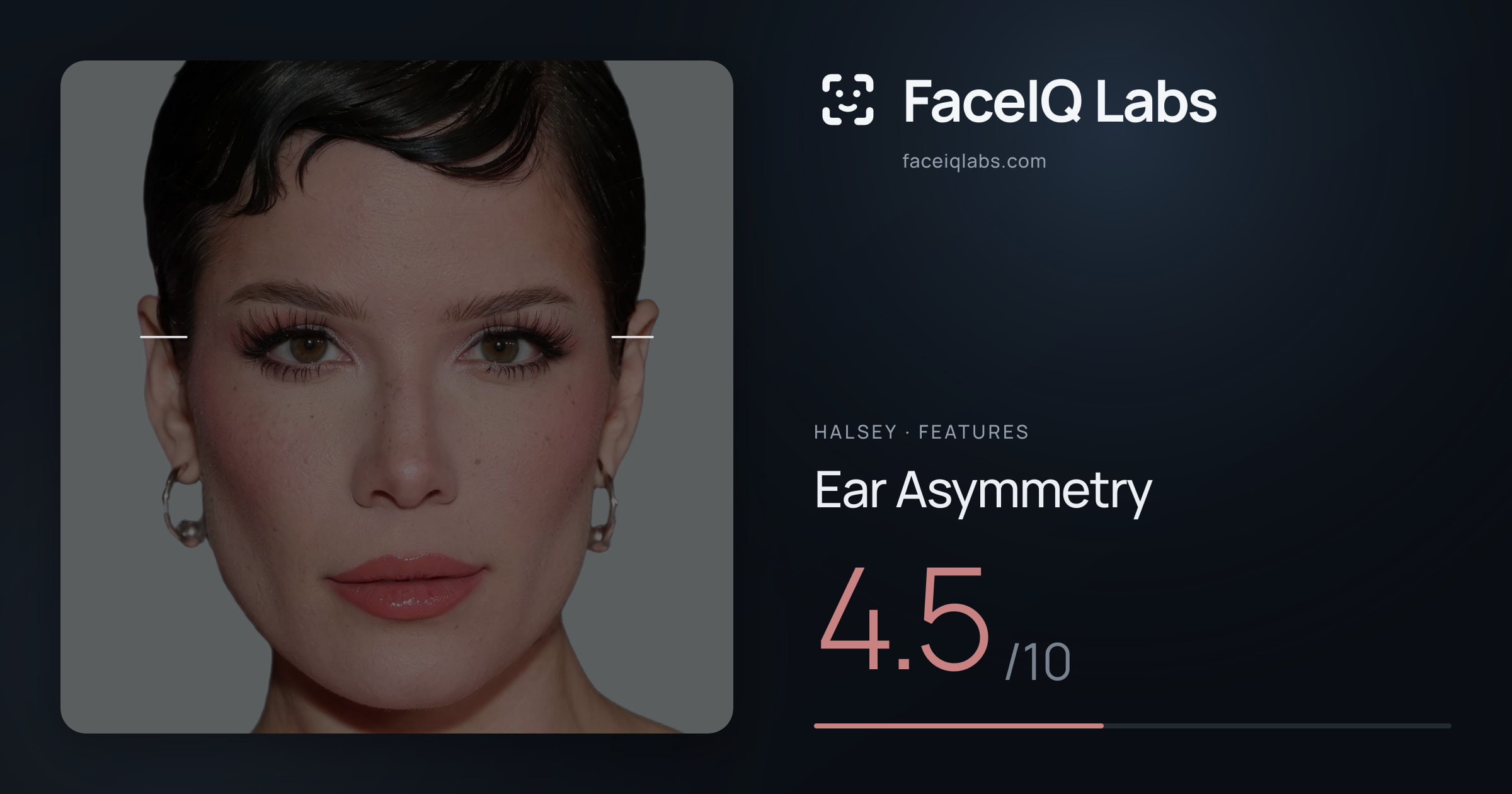 Halsey Ear Asymmetry: 4.5/10, drawn on the photo