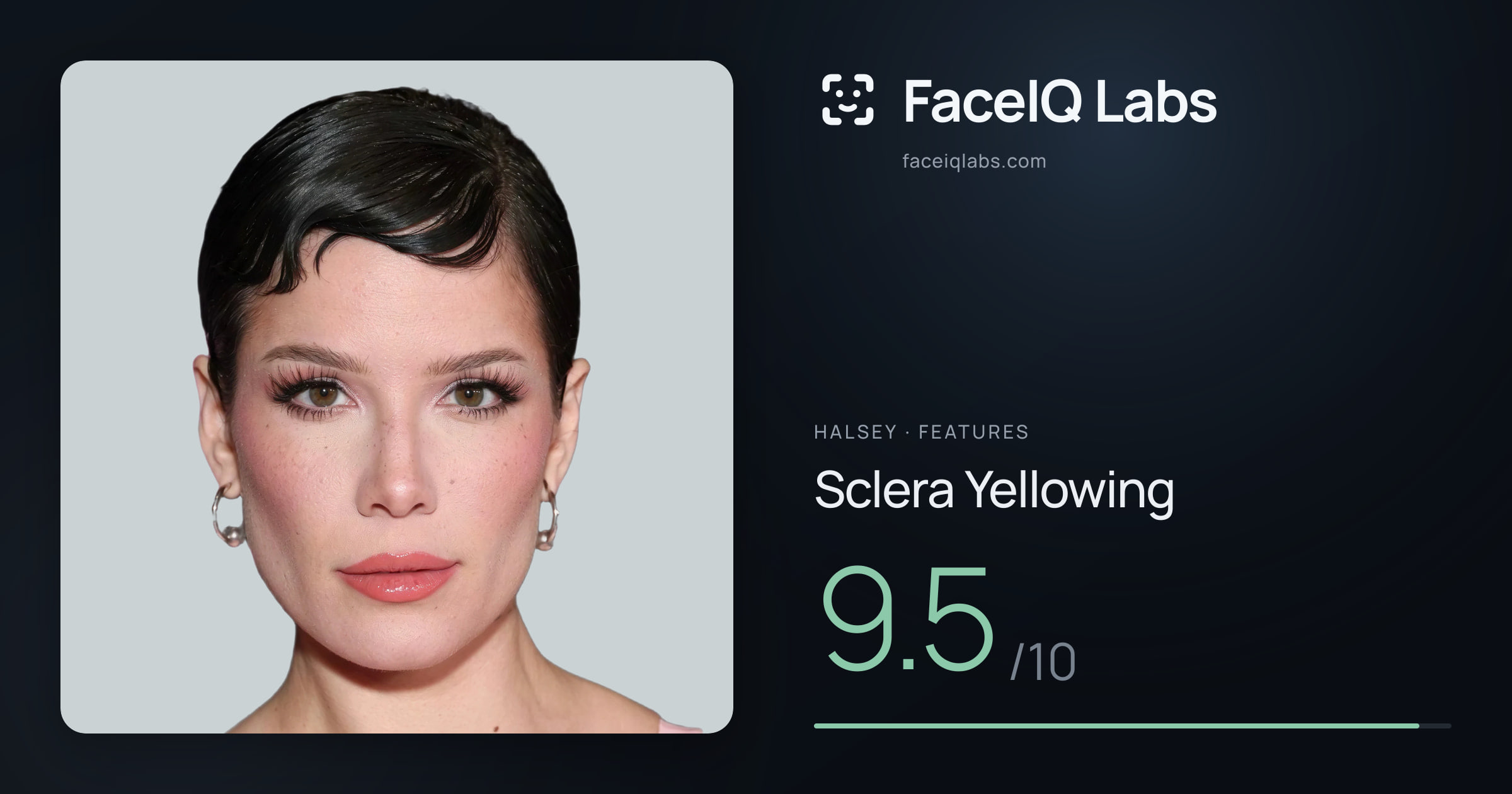 Halsey Sclera Yellowing: 9.5/10, drawn on the photo
