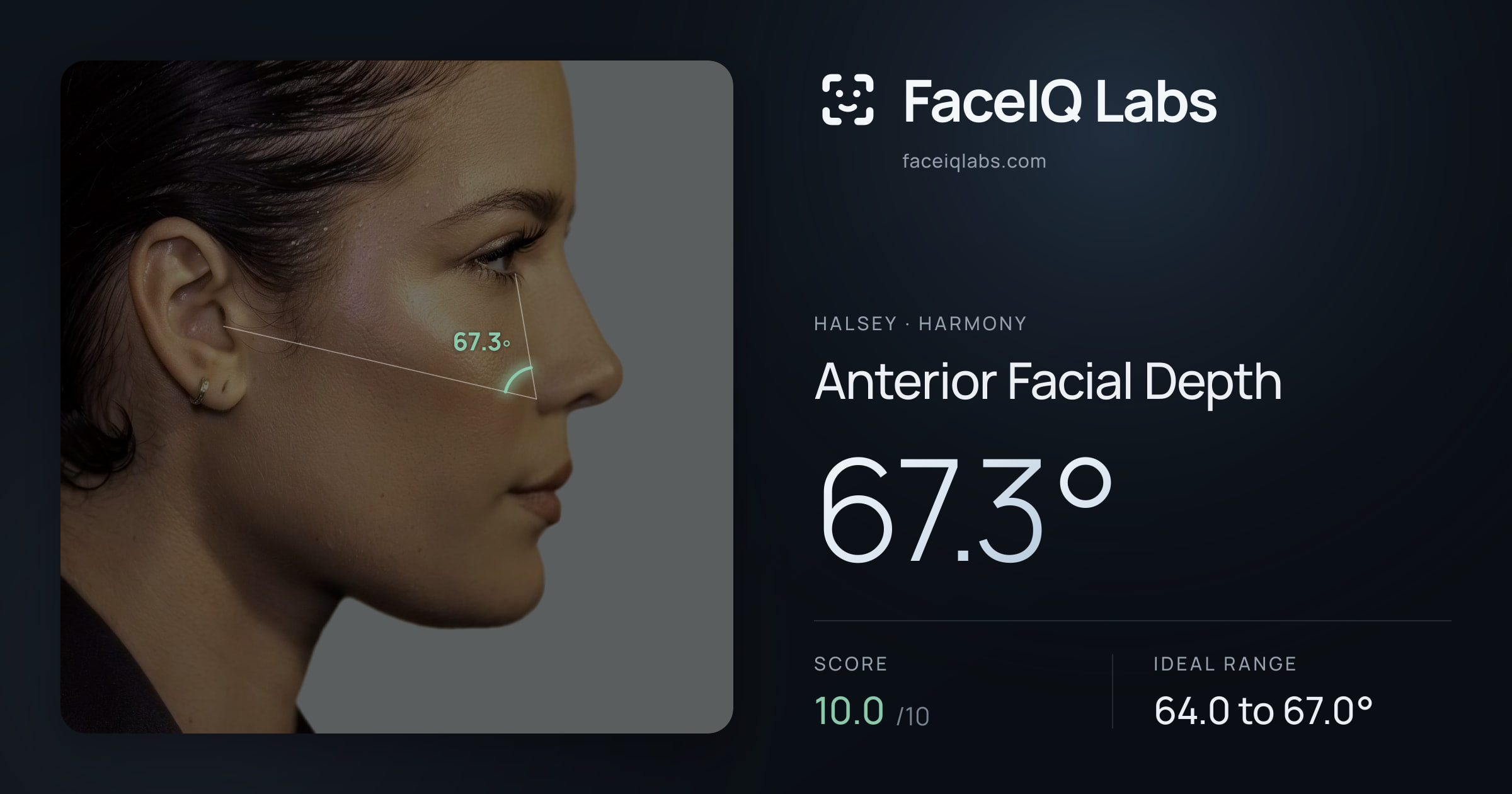 Halsey Anterior Facial Depth: 67.3°, drawn on the photo