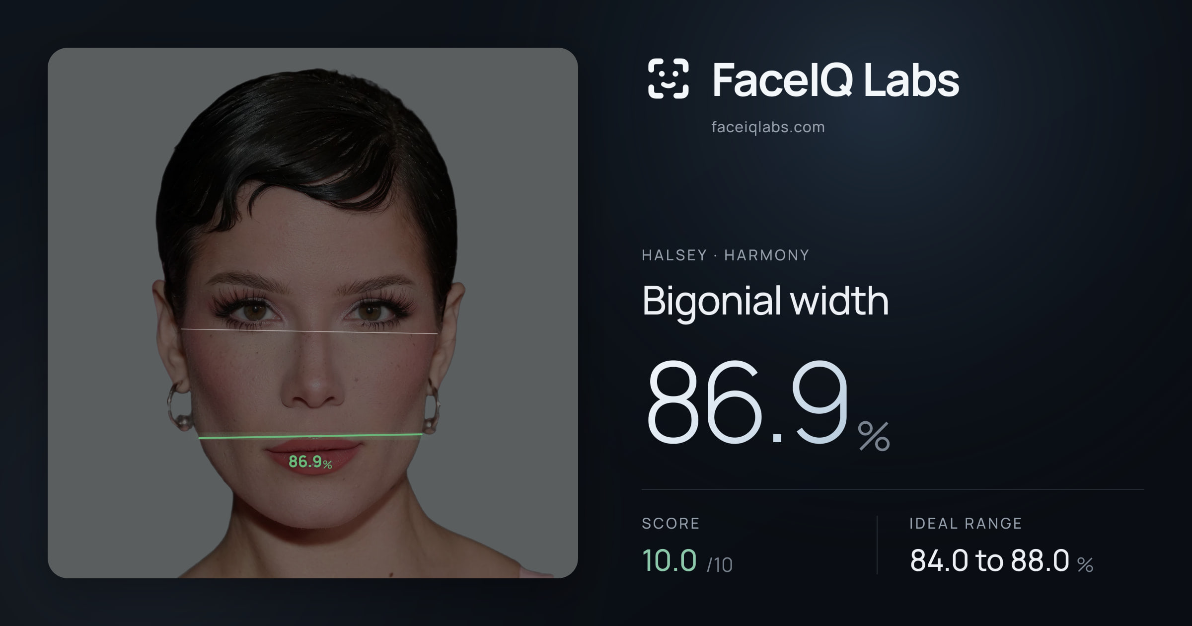 Halsey Bigonial width: 86.9%, drawn on the photo