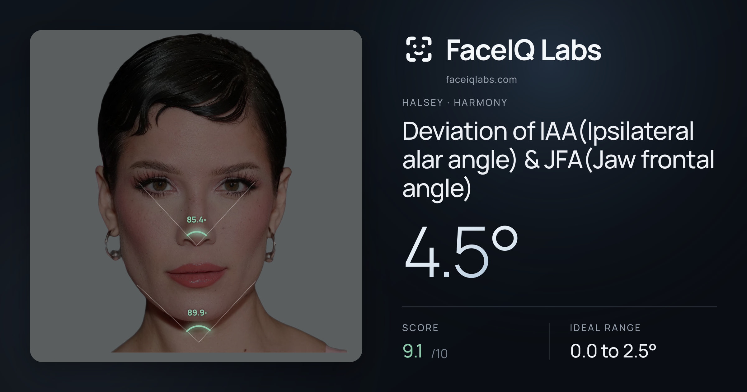 Halsey Deviation of IAA(Ipsilateral alar angle) & JFA(Jaw frontal angle): 4.5°, drawn on the photo