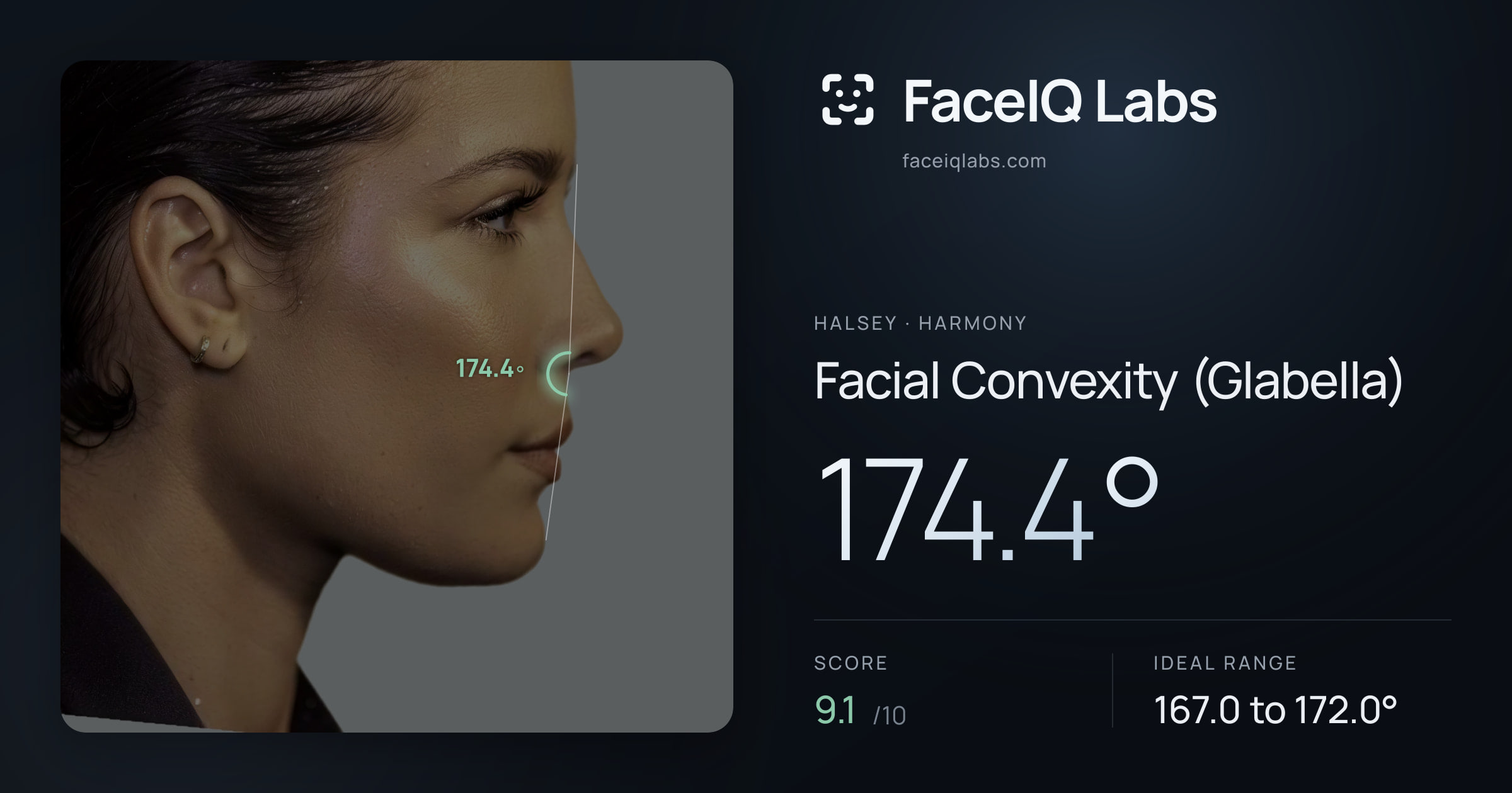 Halsey Facial Convexity (Glabella): 174.4°, drawn on the photo