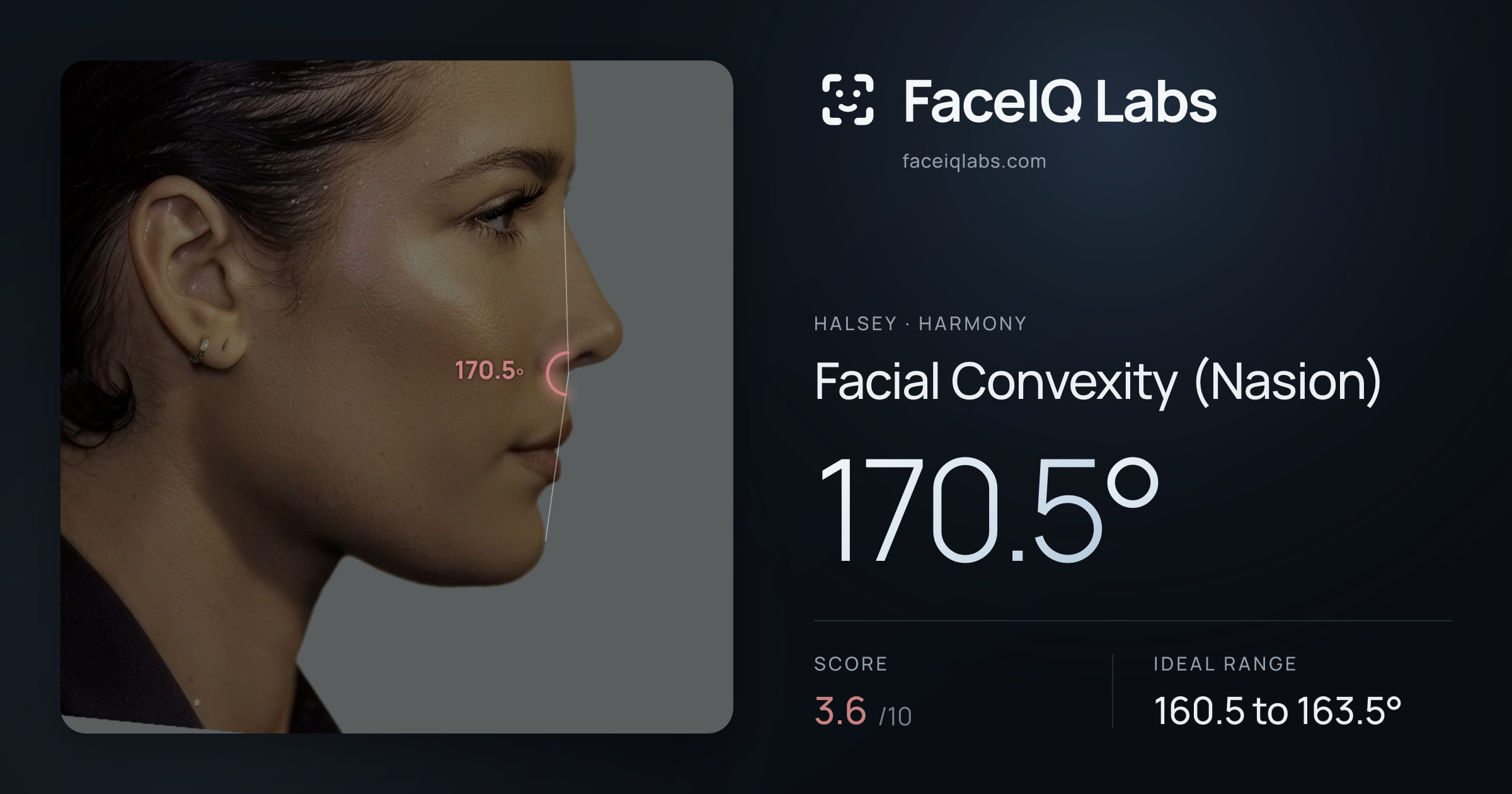 Halsey Facial Convexity (Nasion): 170.5°, drawn on the photo