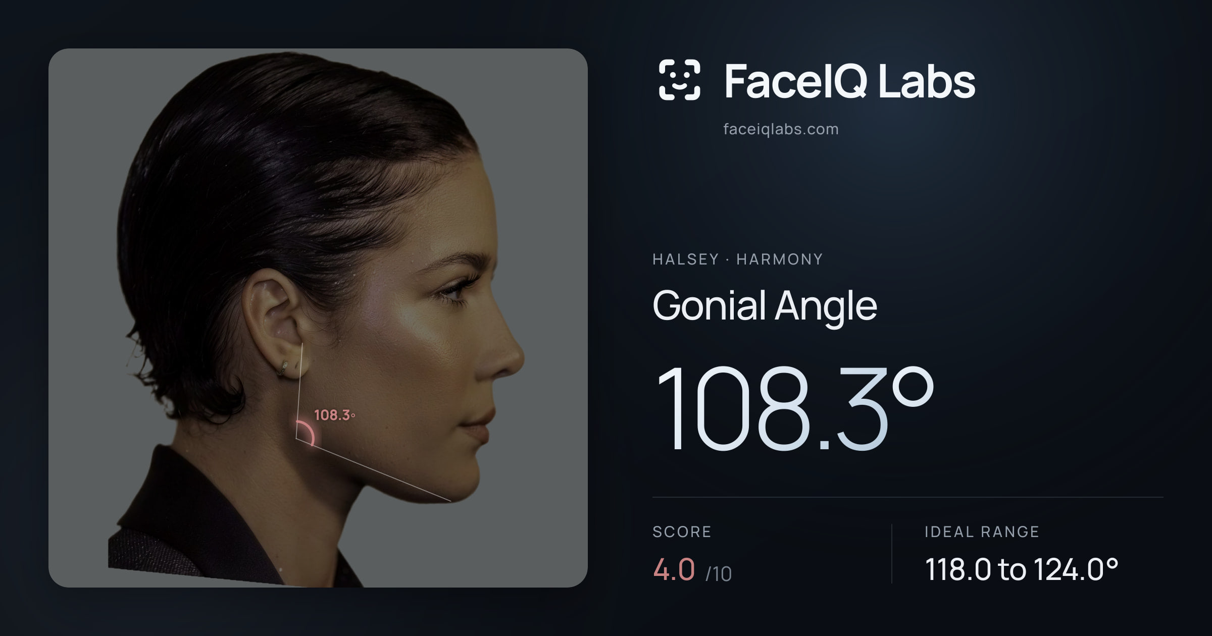 Halsey Gonial Angle: 108.3°, drawn on the photo