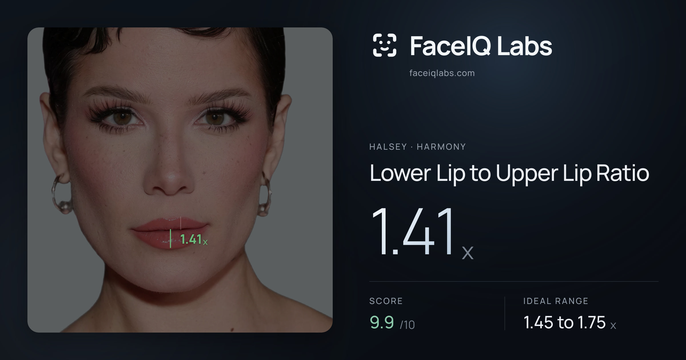 Halsey Lower Lip to Upper Lip Ratio: 1.41x, drawn on the photo