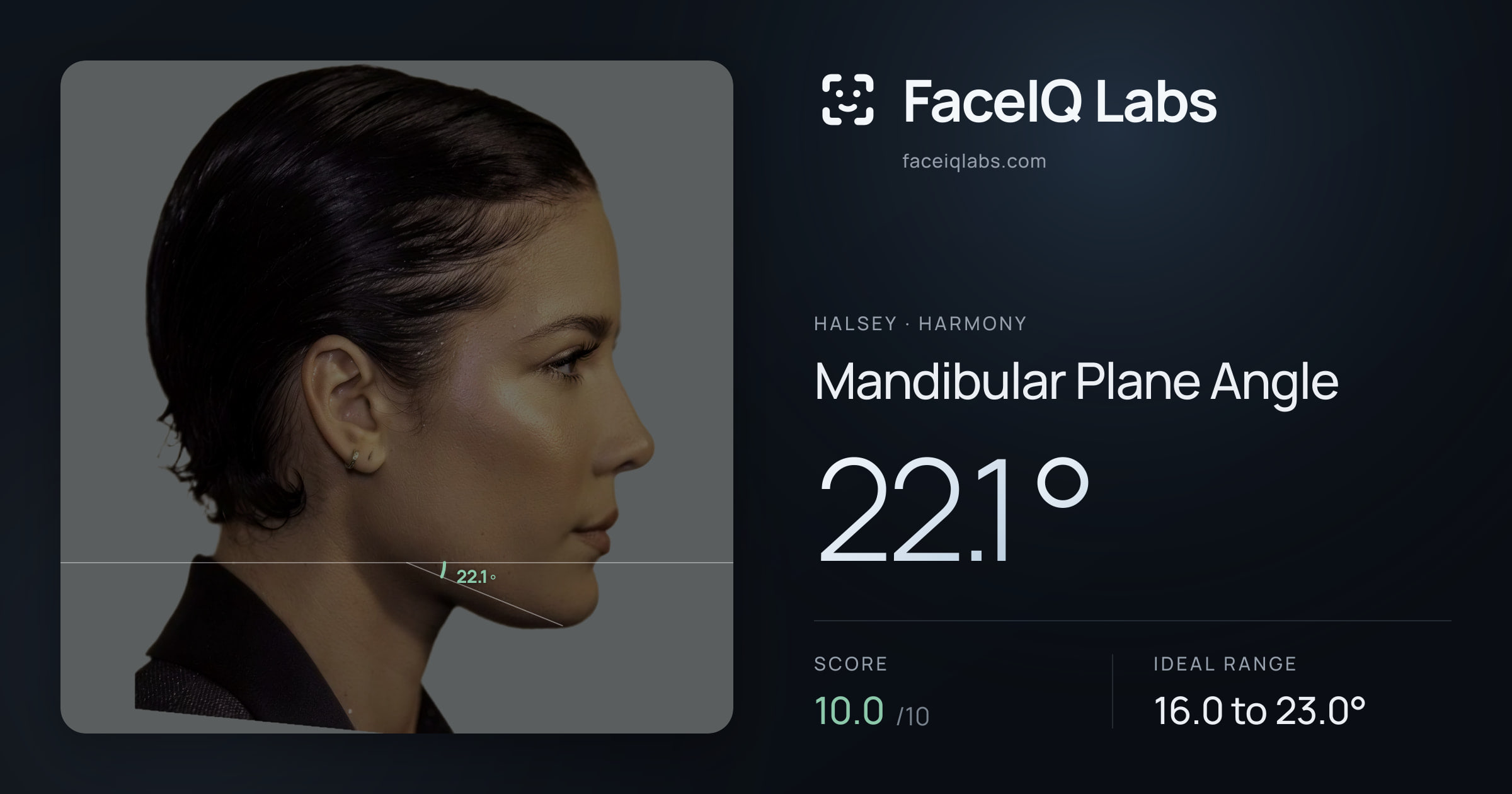 Halsey Mandibular Plane Angle: 22.1°, drawn on the photo