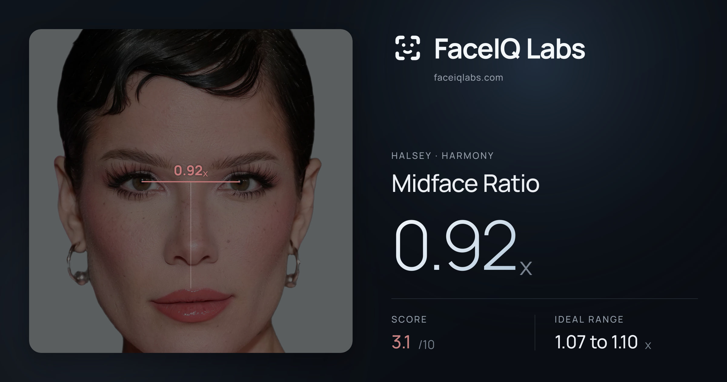 Halsey Midface Ratio: 0.92x, drawn on the photo