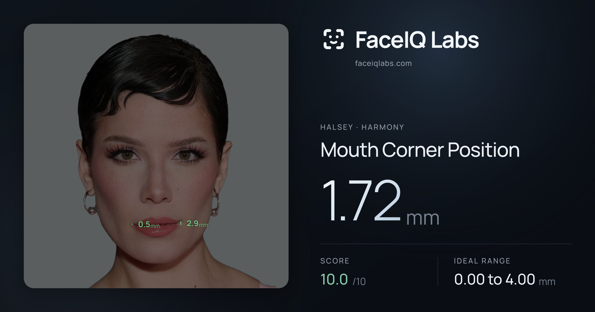 Halsey Mouth Corner Position: 1.72mm, drawn on the photo