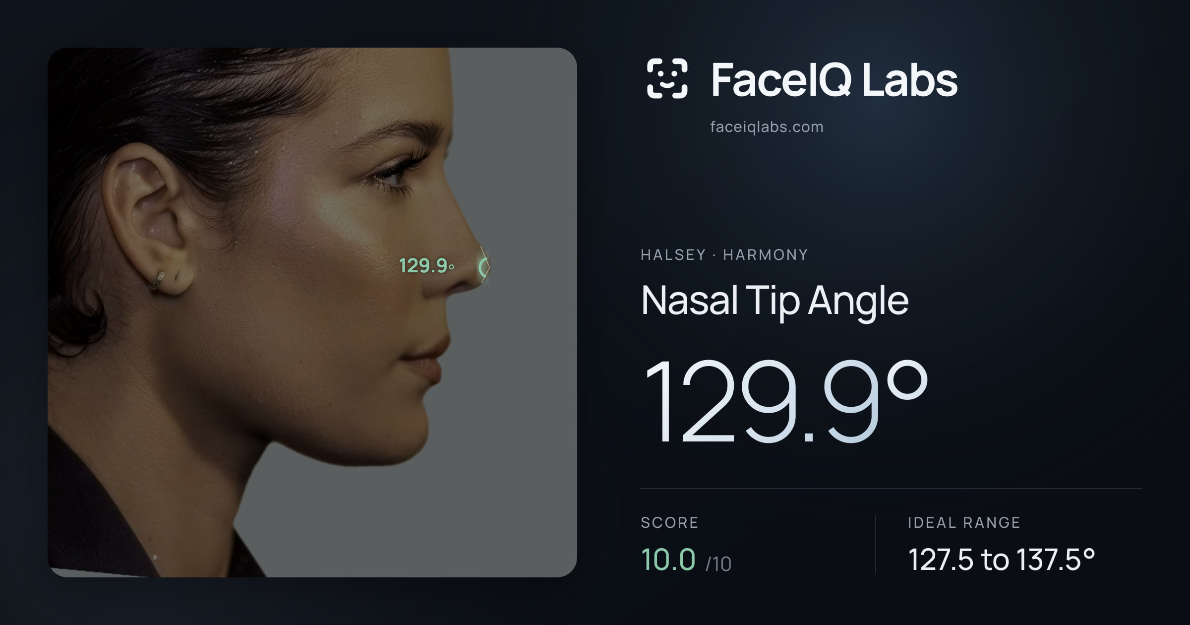 Halsey Nasal Tip Angle: 129.9°, drawn on the photo