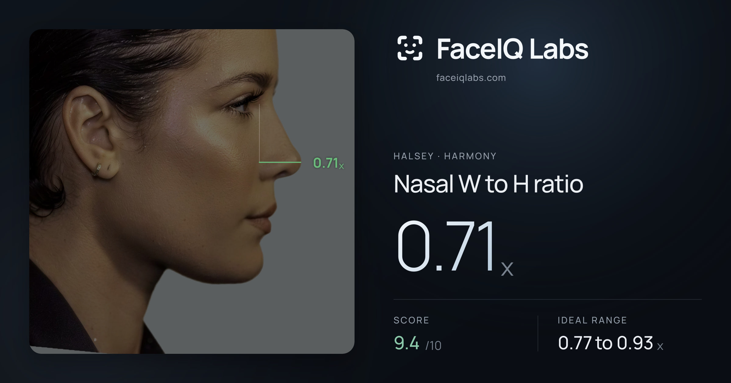Halsey Nasal W to H ratio: 0.71x, drawn on the photo