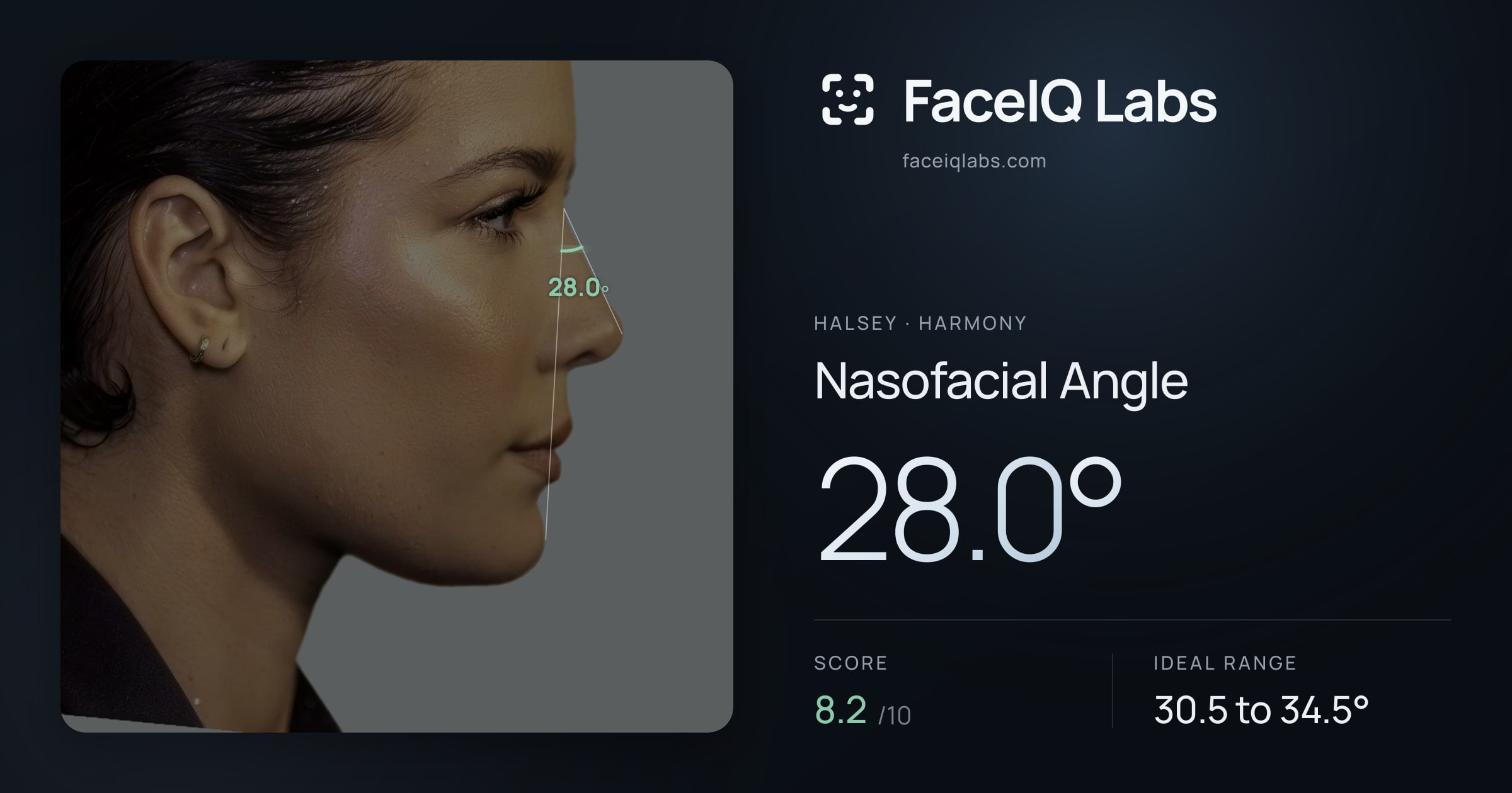 Halsey Nasofacial Angle: 28.0°, drawn on the photo