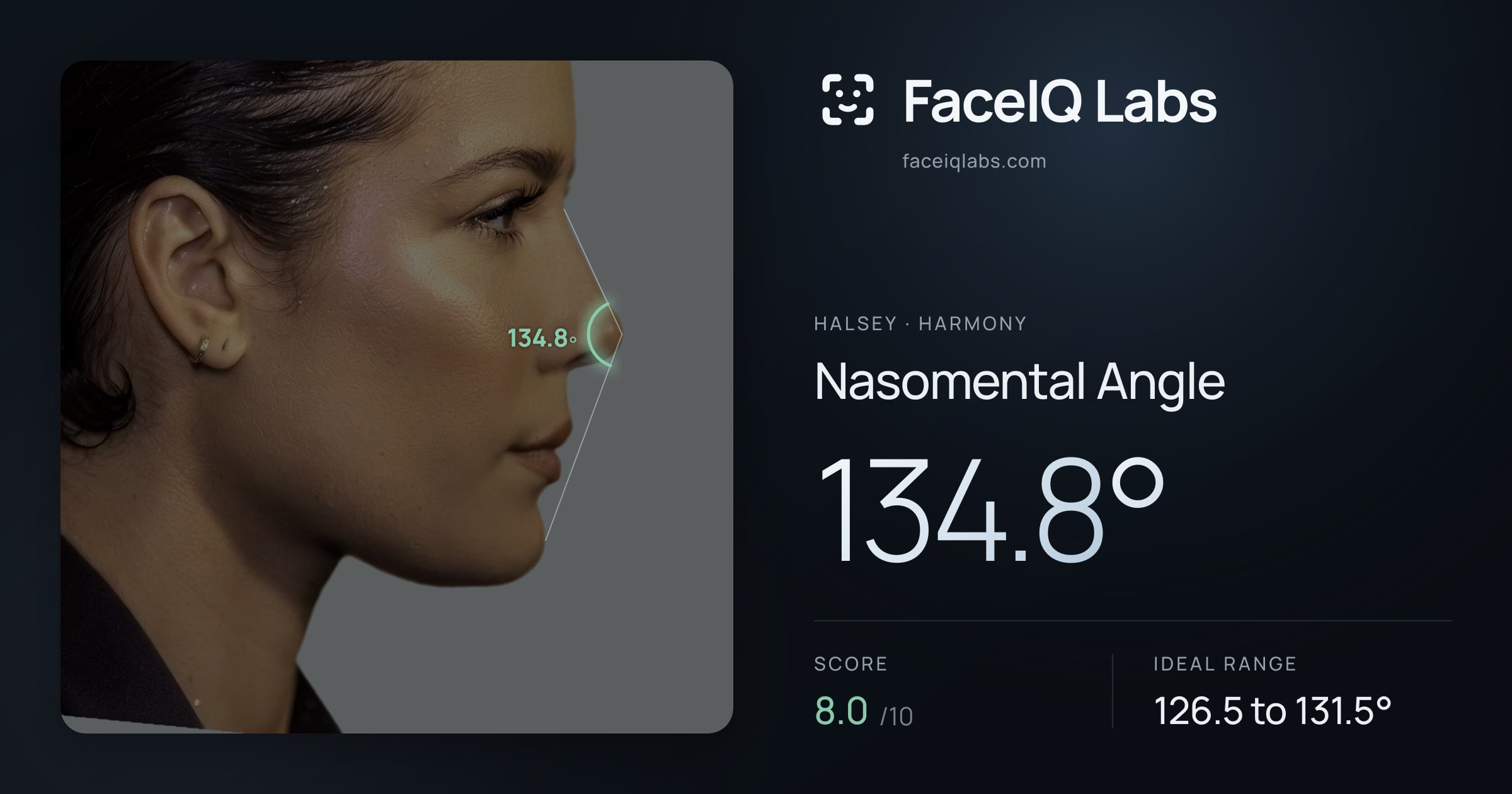 Halsey Nasomental Angle: 134.8°, drawn on the photo
