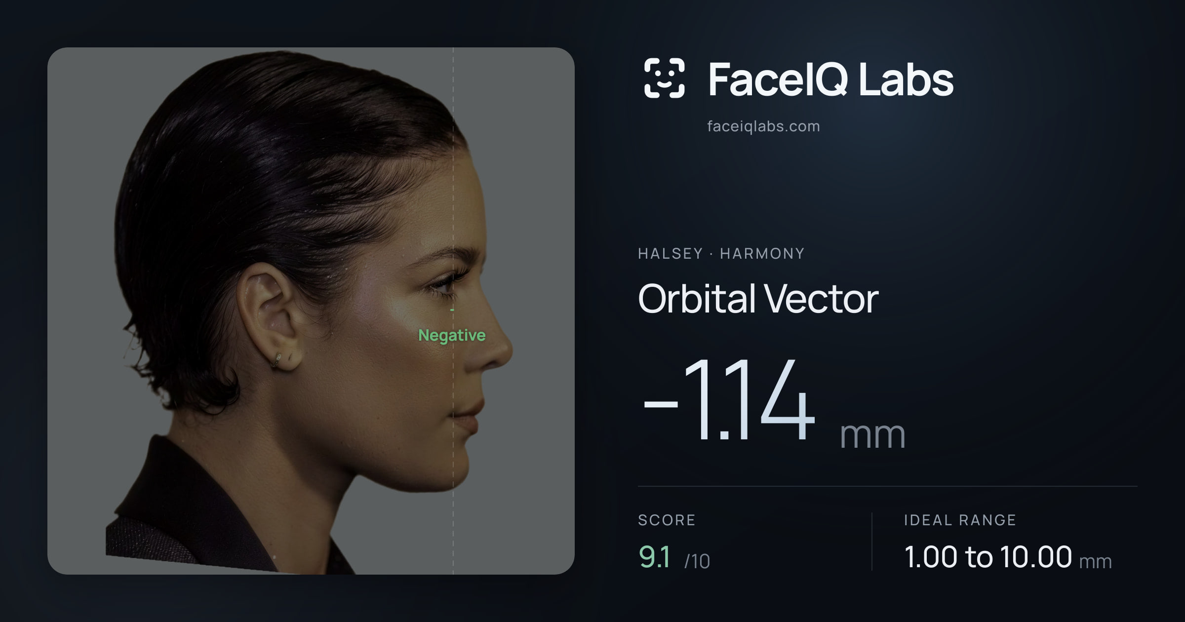 Halsey Orbital Vector: -1.14mm, drawn on the photo